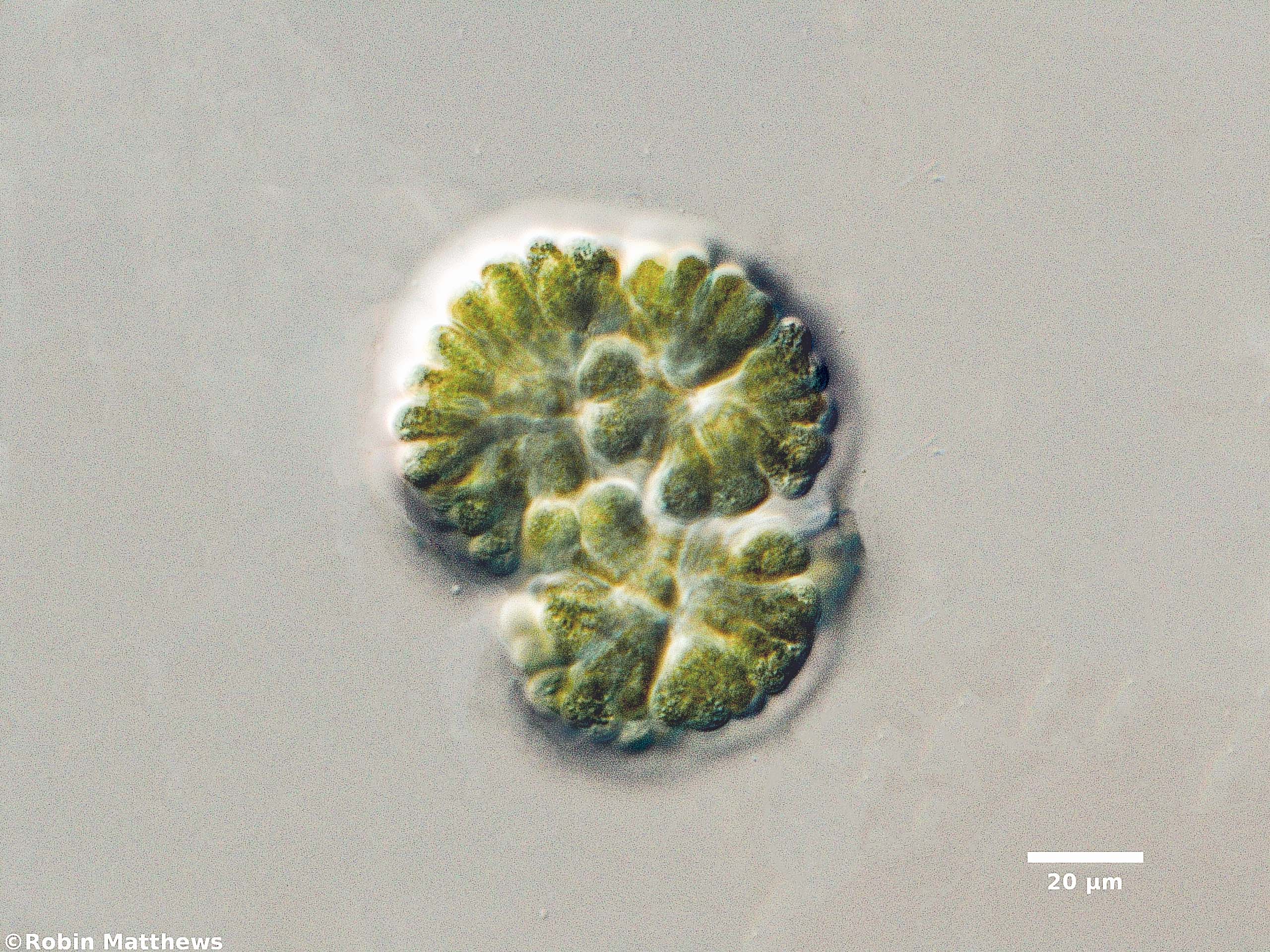 ./Cyanobacteria/Chroococcales/Gomphosphaeriaceae/Gomphosphaeria/aponina/gomphosphaeria-aponia-53.jpg