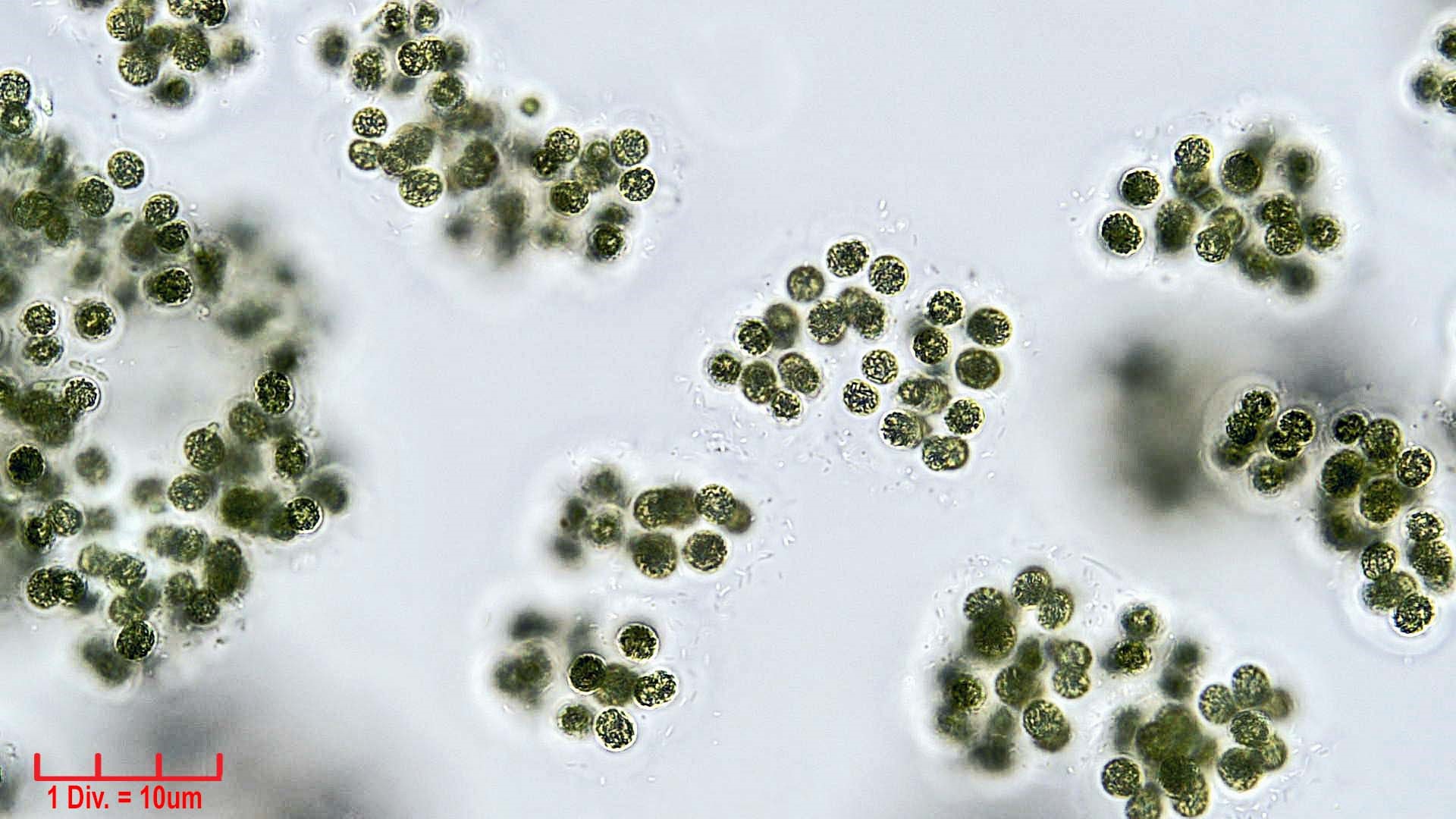./Cyanobacteria/Chroococcales/Microcystaceae/Microcystis/viridis/microcystis-viridis-67.jpg