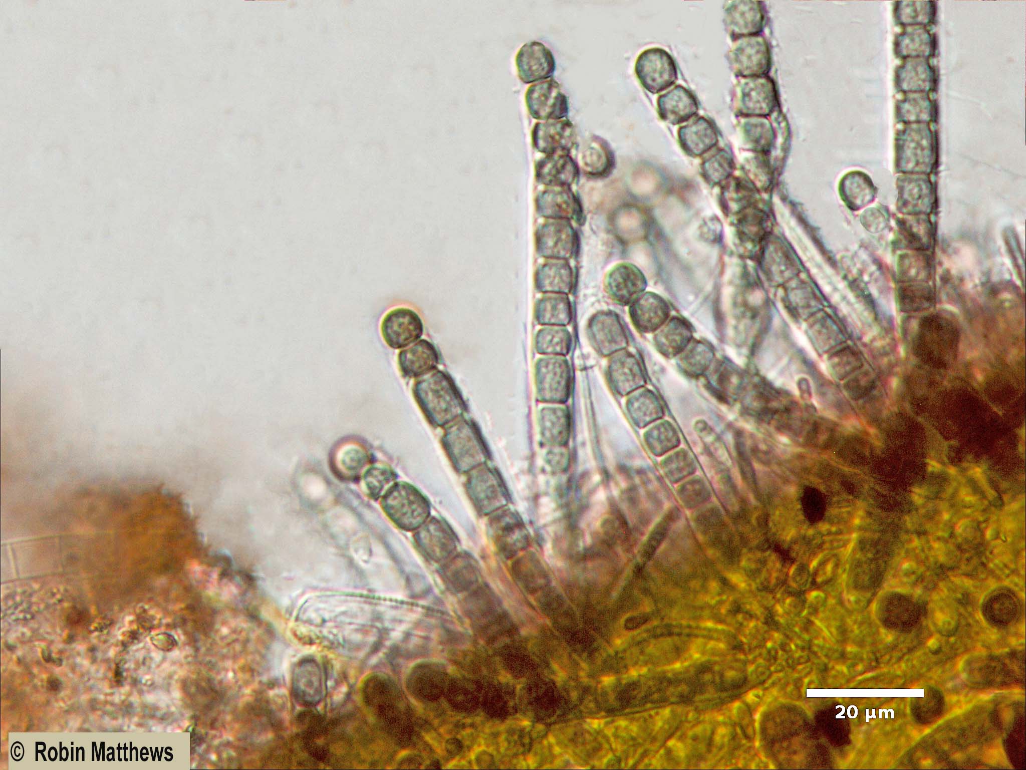 ./Cyanobacteria/Chroococcales/Stichosiphonaceae/Stichosiphon/willei/stichosiphon-willei-58.jpg