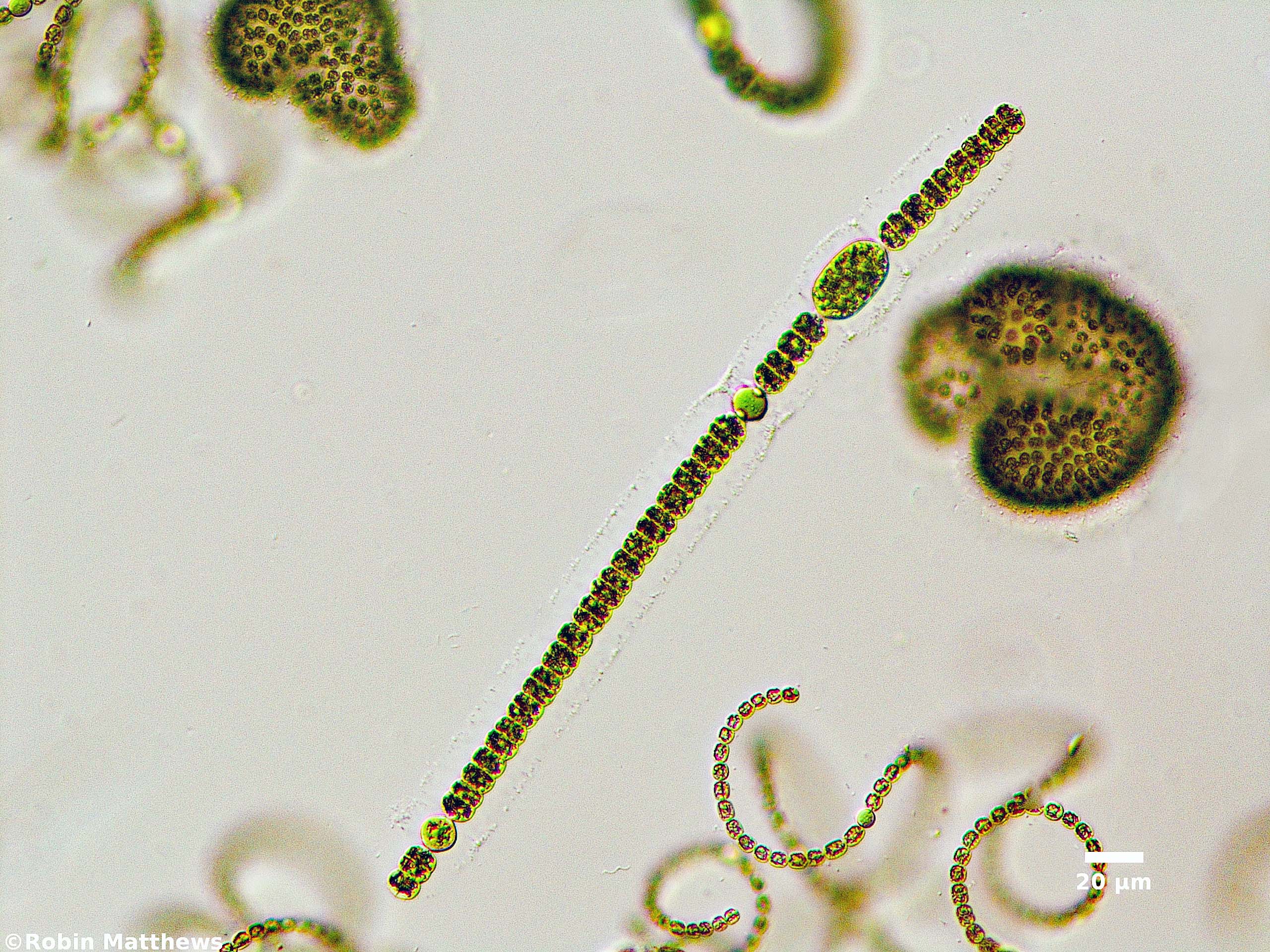 ./Cyanobacteria/Nostocales/Aphanizomenonaceae/Dolichospermum/planctonicum/dolichospermum-576.jpg