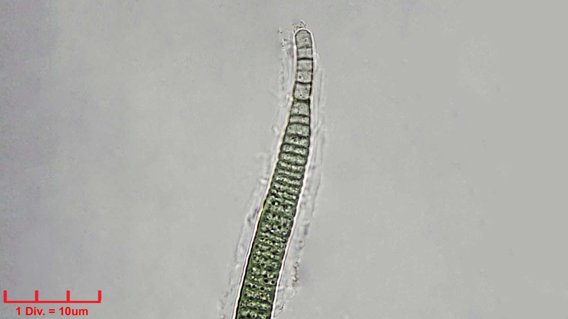 ./Cyanobacteria/Nostocales/Rivulariaceae/Calothrix/confervicola/calothrix-confervicola-448.jpg