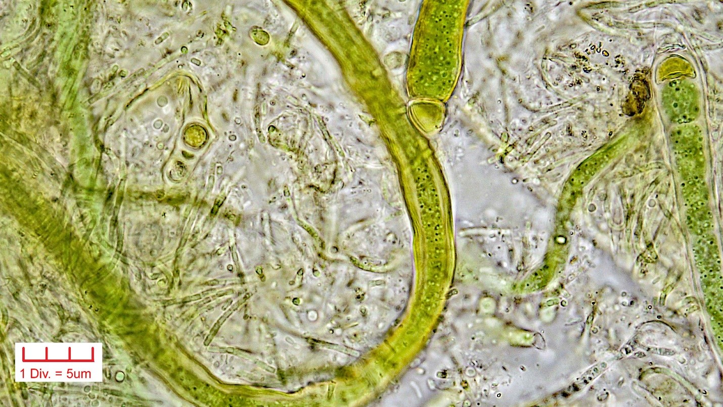 ./Cyanobacteria/Nostocales/Rivulariaceae/Calothrix/parietina/calothrix-parietina-440.jpg