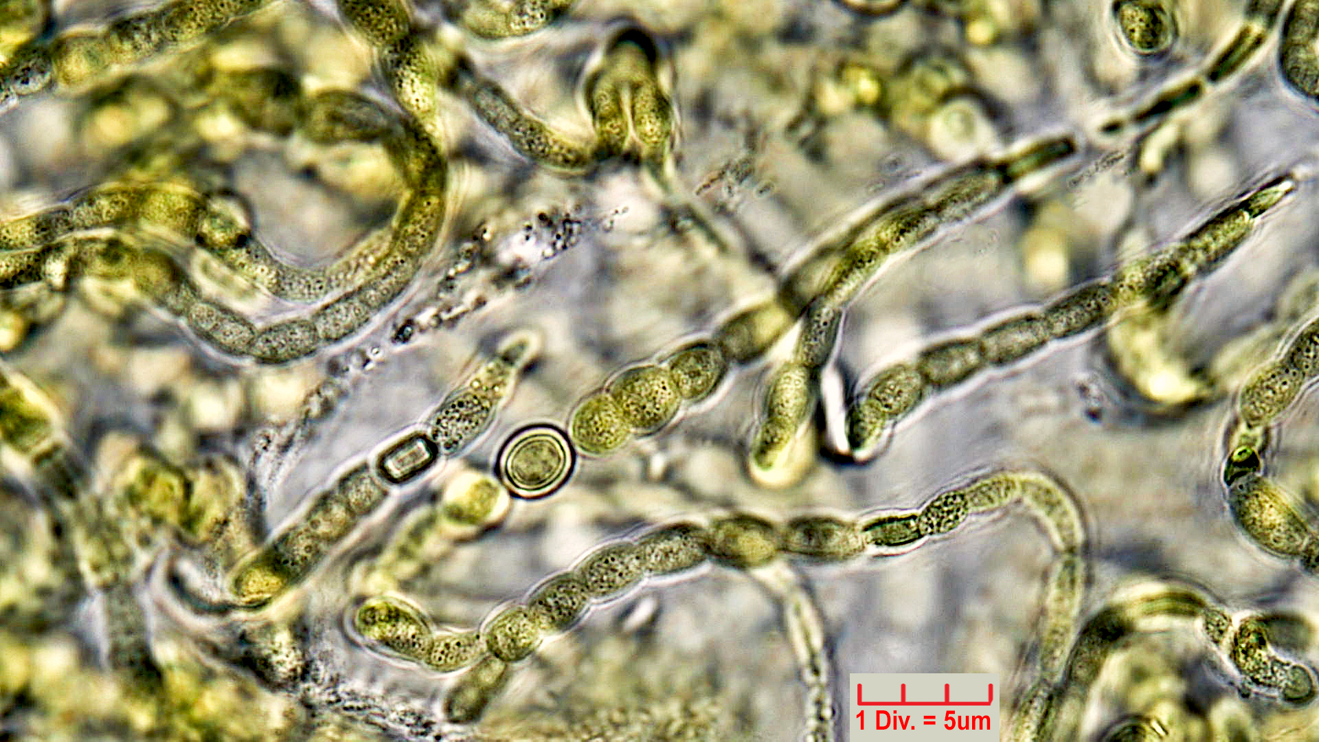 ./Cyanobacteria/Nostocales/Symphyonemataceae/Brachytrichia/sp/brachytrichia-6.jpg