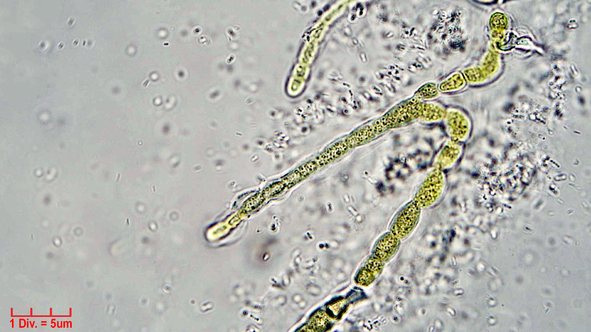 ./Cyanobacteria/Nostocales/Symphyonemataceae/Brachytrichia/sp/brachytrichia-8.jpg