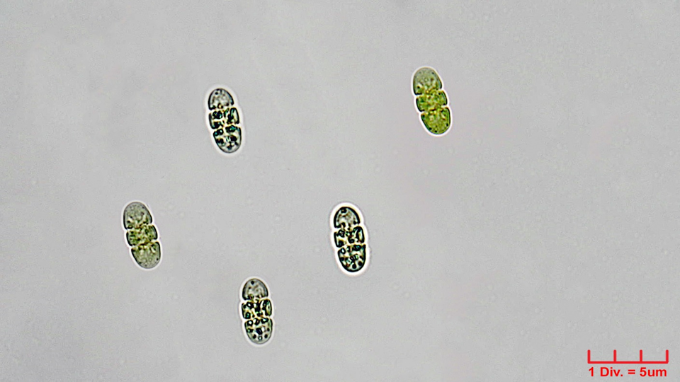 ././Cyanobacteria/Oscillatoriales/Borziaceae/Borzia/triocularis/borzia-triocularis-239.png