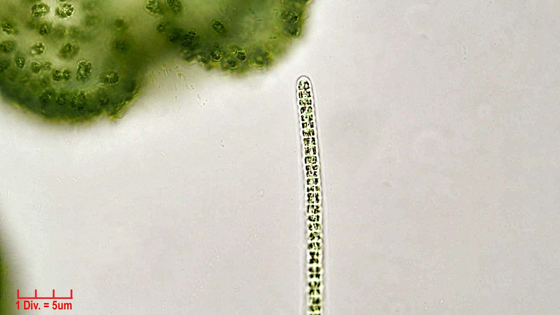 ./Cyanobacteria/Oscillatoriales/Microcoleaceae/Planktothrix/agardhii/planktothrix-agardhii-245.jpg