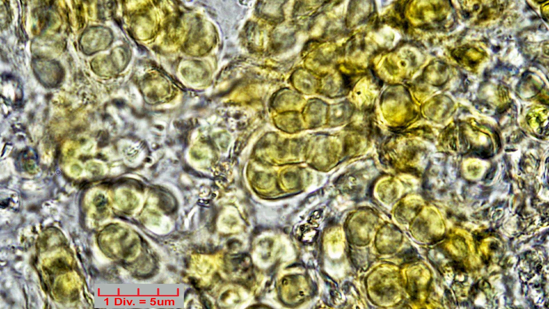 ./Cyanobacteria/Pleurocapsales/Hyellaceae/Pleurocapsa/fuliginosa/pleurocapsa-fuliginosa-163.jpg