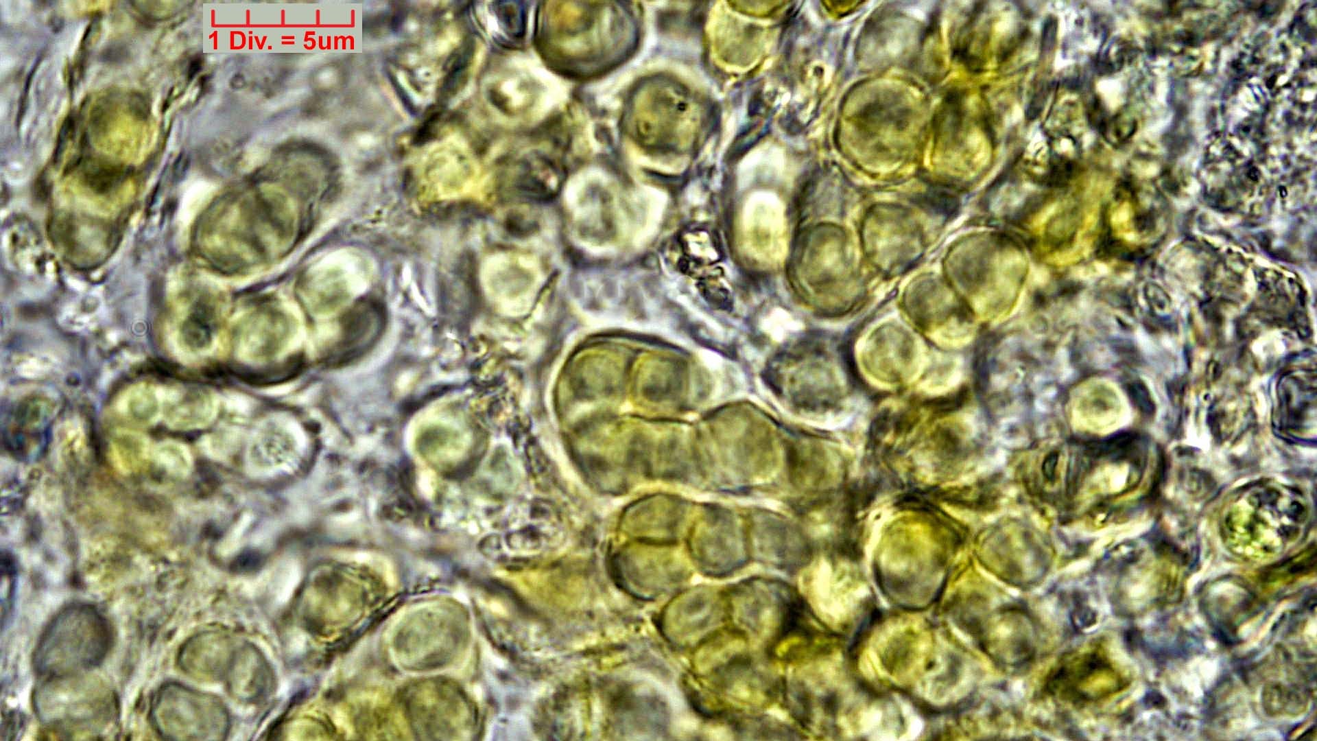 ./Cyanobacteria/Pleurocapsales/Hyellaceae/Pleurocapsa/fuliginosa/pleurocapsa-fuliginosa-165.jpg