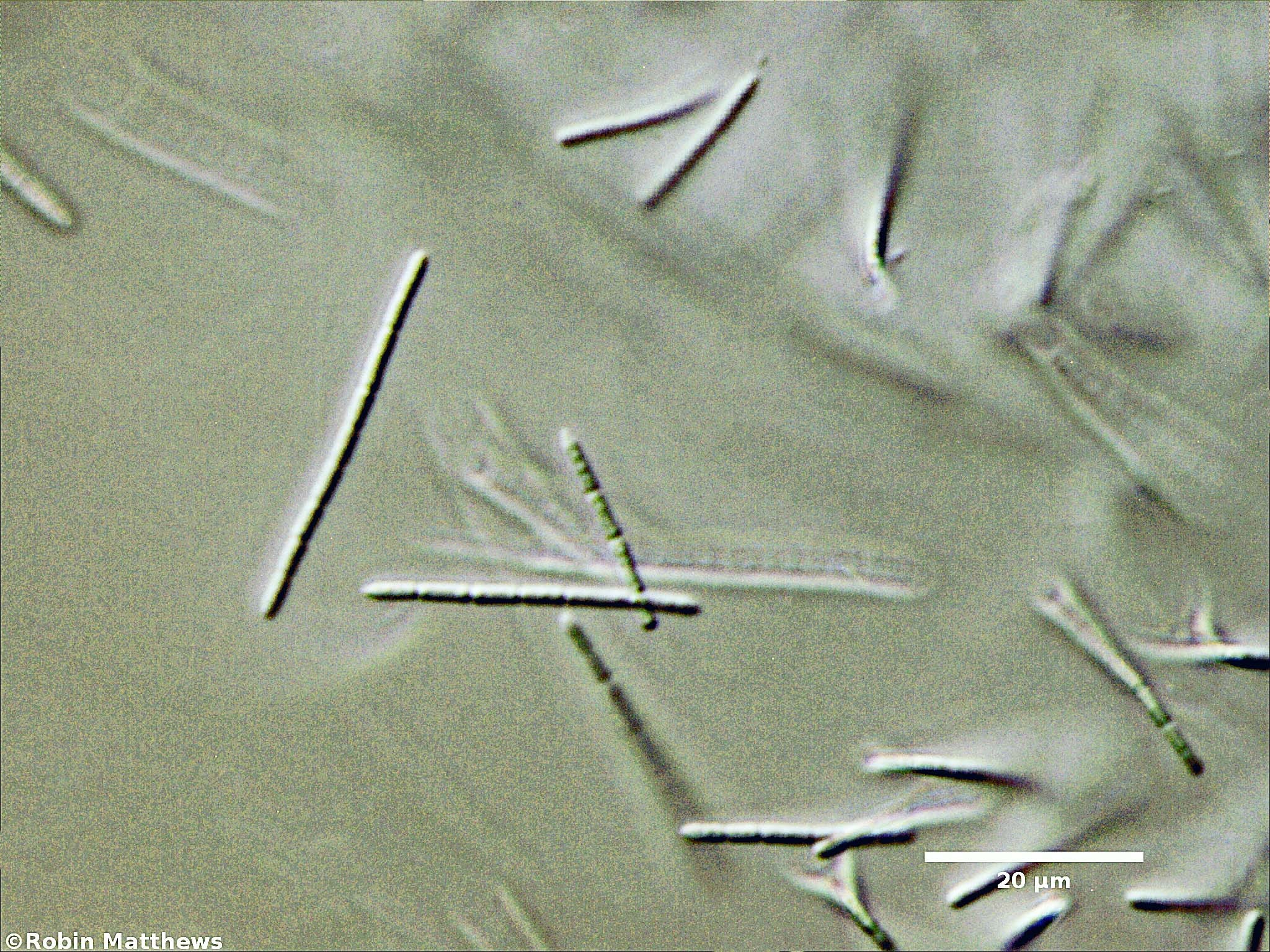 ./Cyanobacteria/Synechococcales/Pseudanabaenaceae/Pseudanabaena/arcuata/pseudanabaena-arcuata-133.jpg