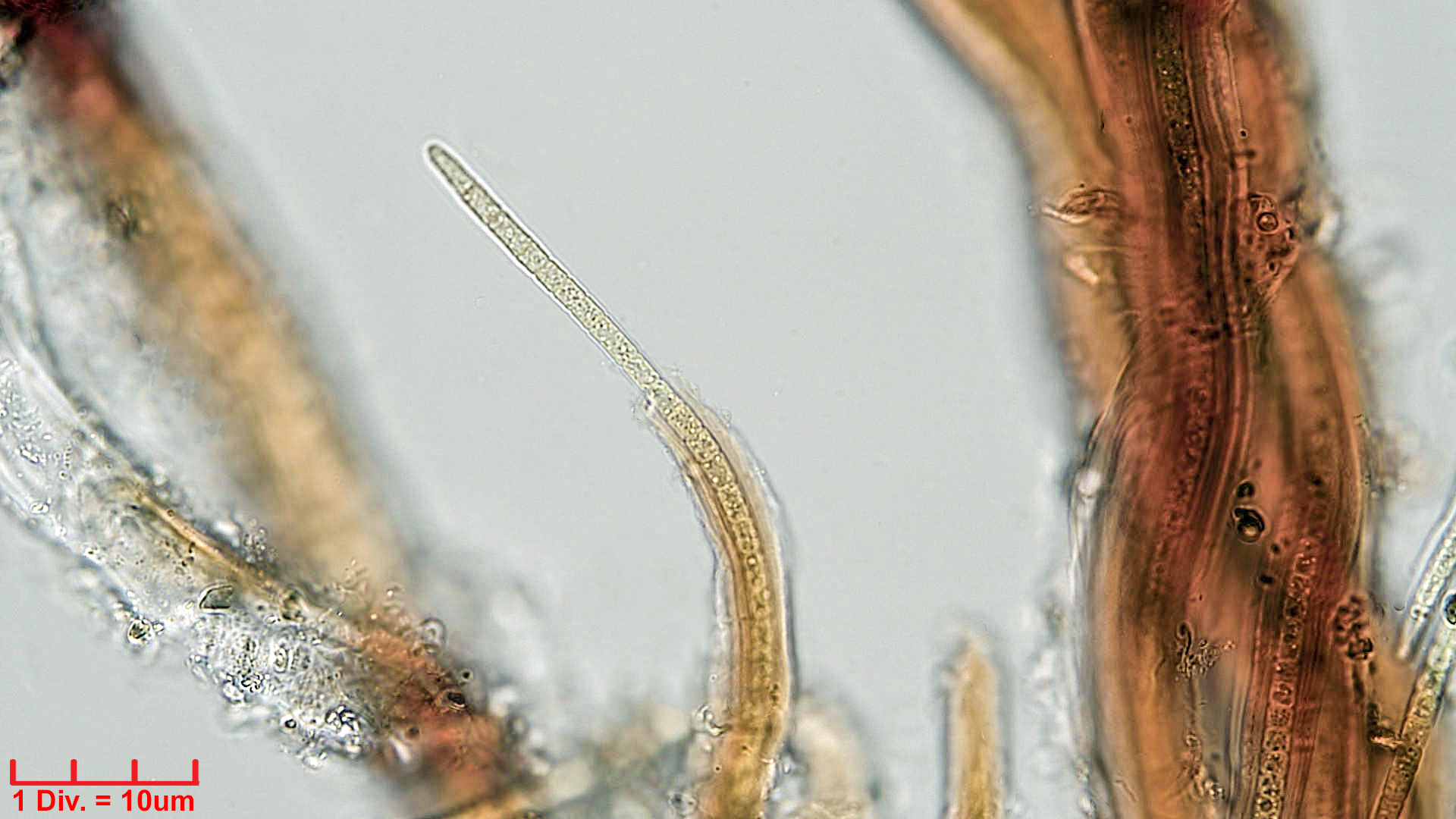 Cyanobacteria/Synechococcales/Schizotrichaceae/Dasygloea/lamyi/dasygloea-lamyi-4.jpg