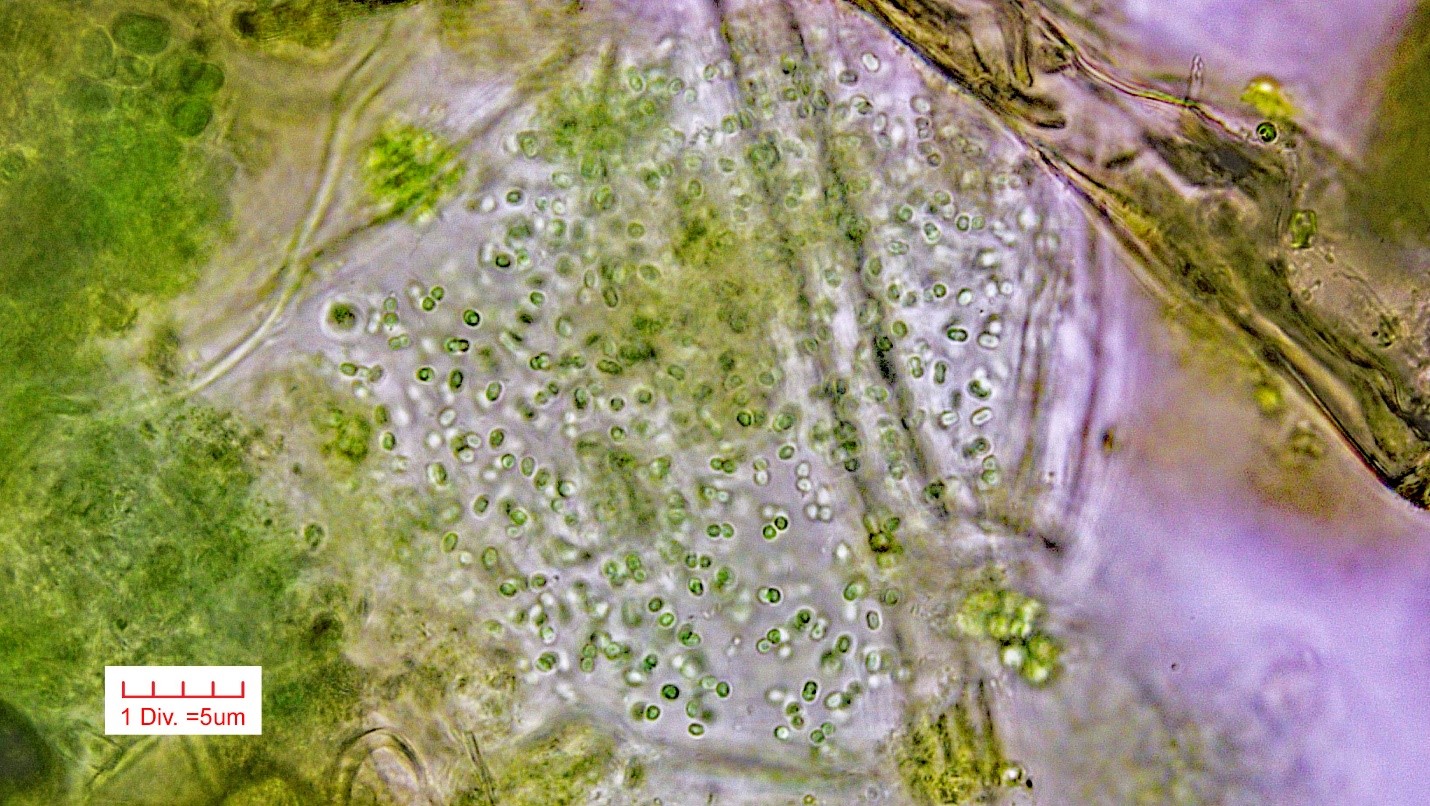 ././Cyanobacteria/Chroococcales/Aphanothecaceae/Aphanothece/nidulans/aphanothece-nidulans-5.jpg