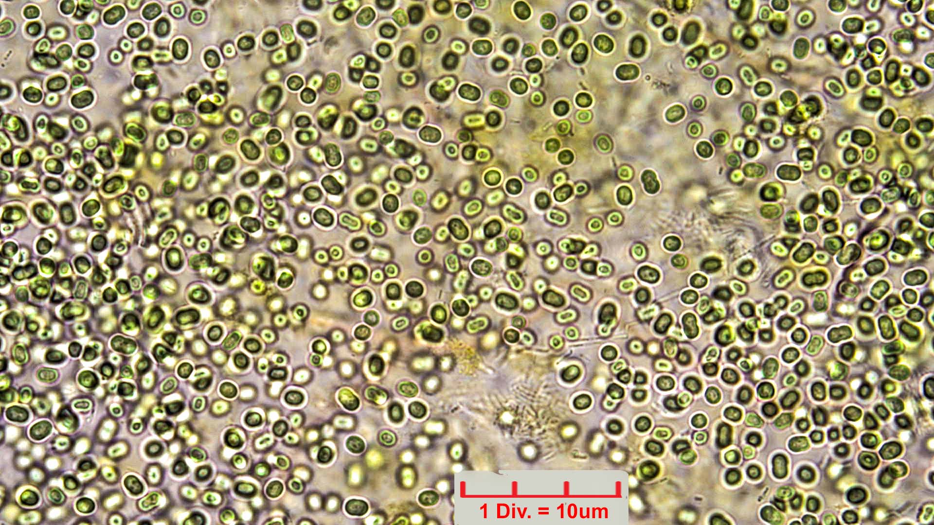 Cyanobacteria/Chroococcales/Aphanothecaceae/Aphanothece/saxicola/aphanothece-saxicola-10.jpg