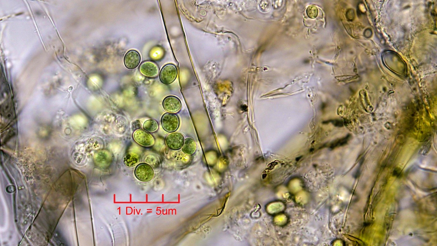 ./Cyanobacteria/Chroococcales/Aphanothecaceae/Aphanothece/stagnina/aphanothece-stagnina-3.jpg