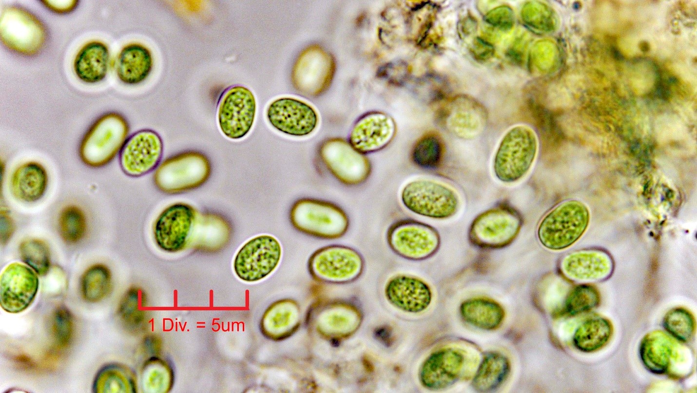 ./Cyanobacteria/Chroococcales/Aphanothecaceae/Aphanothece/stagnina/aphanothece-stagnina-4.jpg