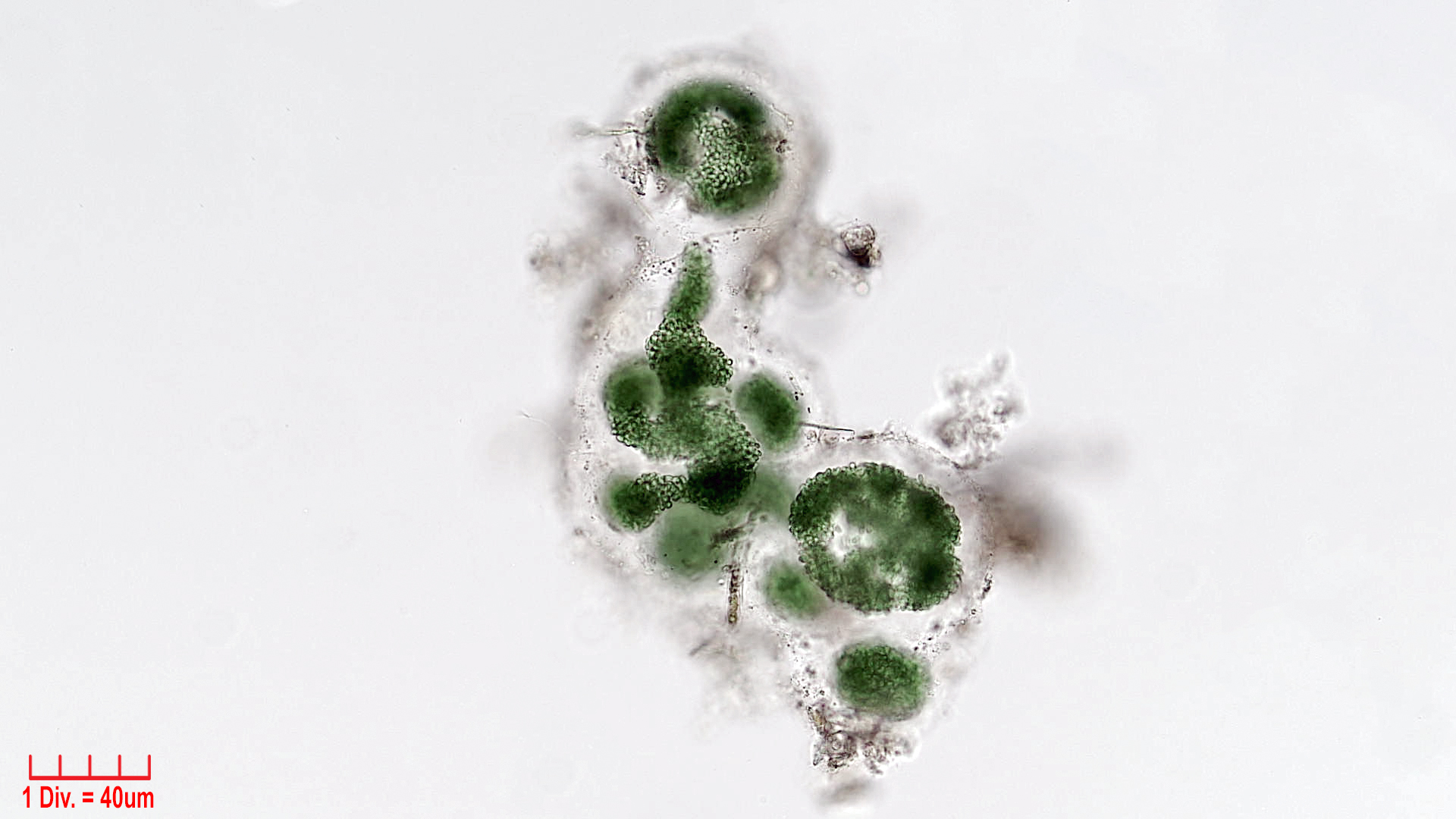 Cyanobacteria/Chroococcales/Aphanothecaceae/Aphanothece/stagnina/aphanothece-stagnina-5.jpg