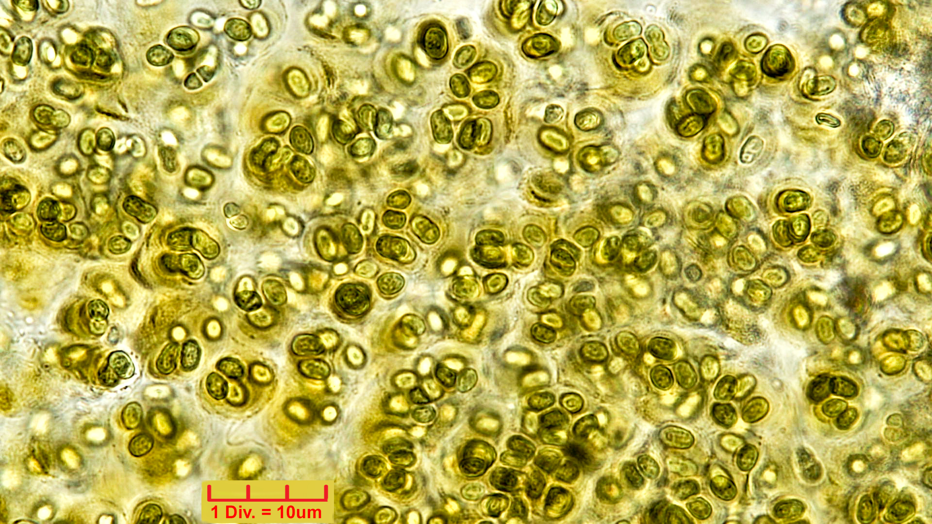 Cyanobacteria/Chroococcales/Aphanothecaceae/Gloeothece/fusco-lutea/gloeothece-fusco-lutea-12.jpg