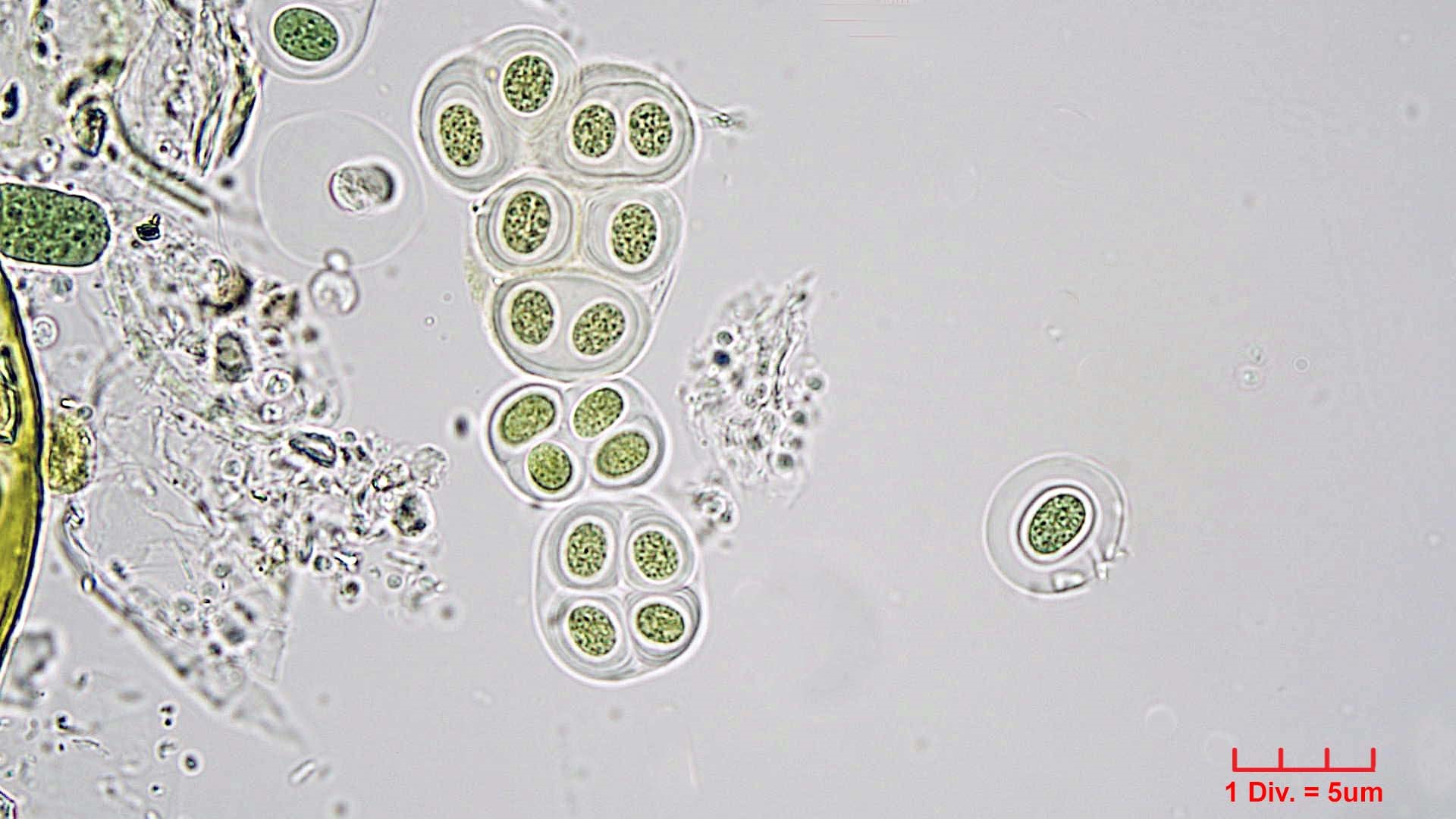 ././Cyanobacteria/Chroococcales/Aphanothecaceae/Gloeothece/rupestris/gloeothece-rupestris-17.jpg