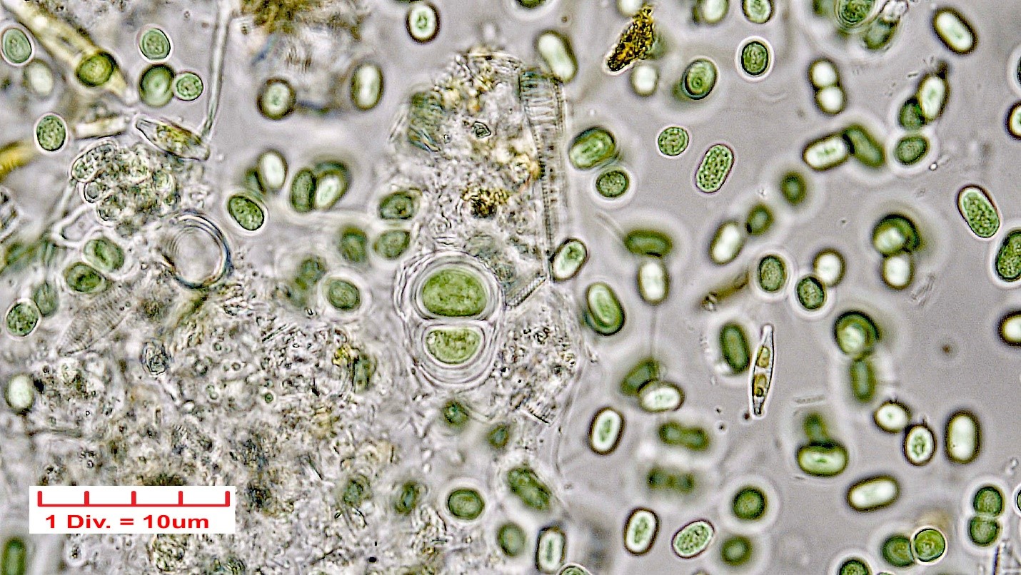 ./Cyanobacteria/Chroococcales/Chroococcaceae/Chroococcus/turgidus/chroococcus-turgidus-21.jpg