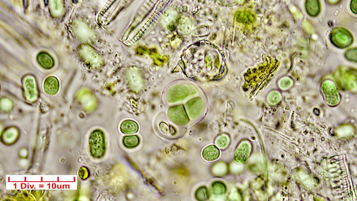 ./Cyanobacteria/Chroococcales/Chroococcaceae/Chroococcus/turgidus/chroococcus-turgidus-22.jpg