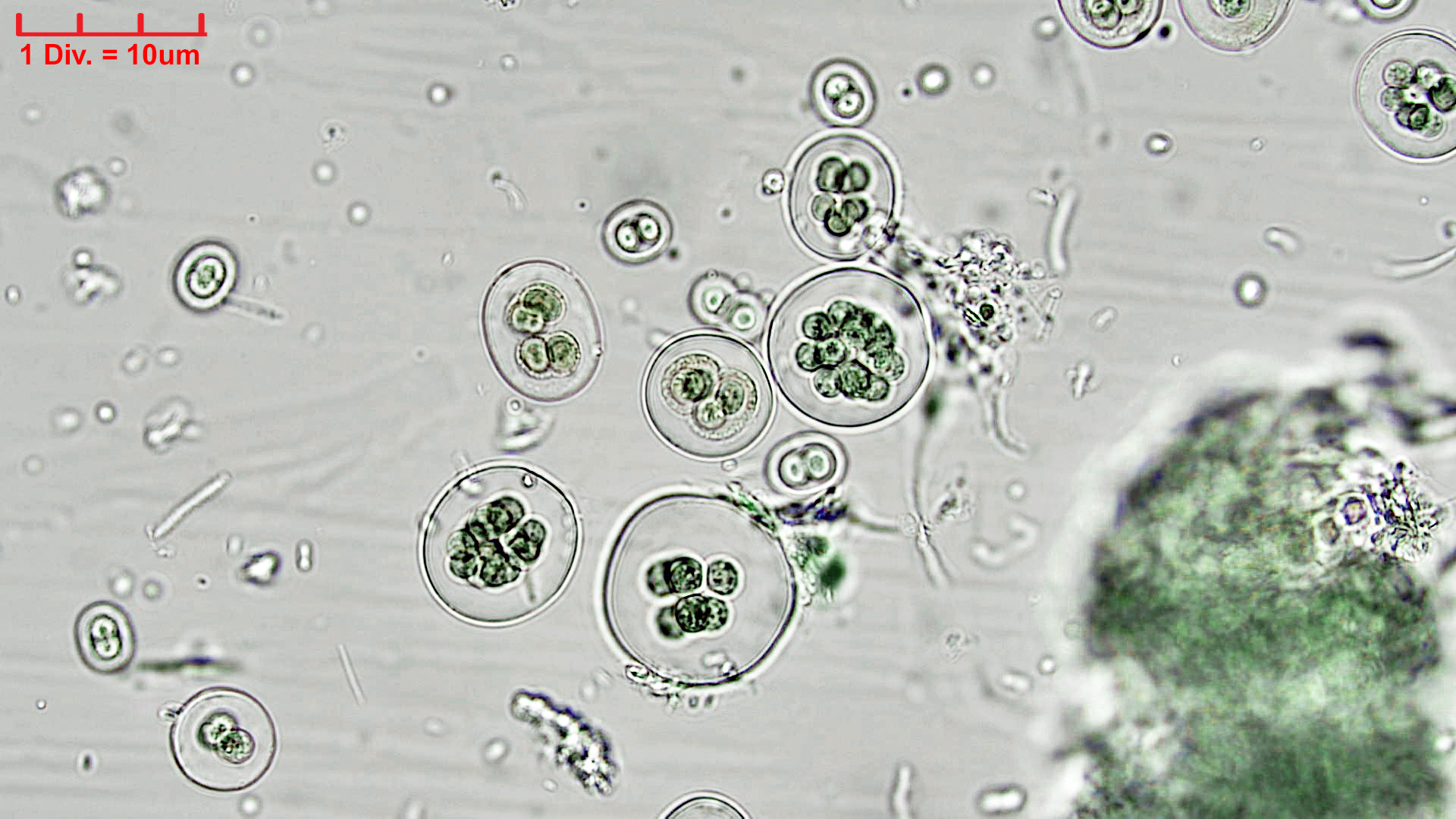 Cyanobacteria/Chroococcales/Chroococcaceae/Gloeocapsa/atrata/gloeocapsa-atrata-35.jpg