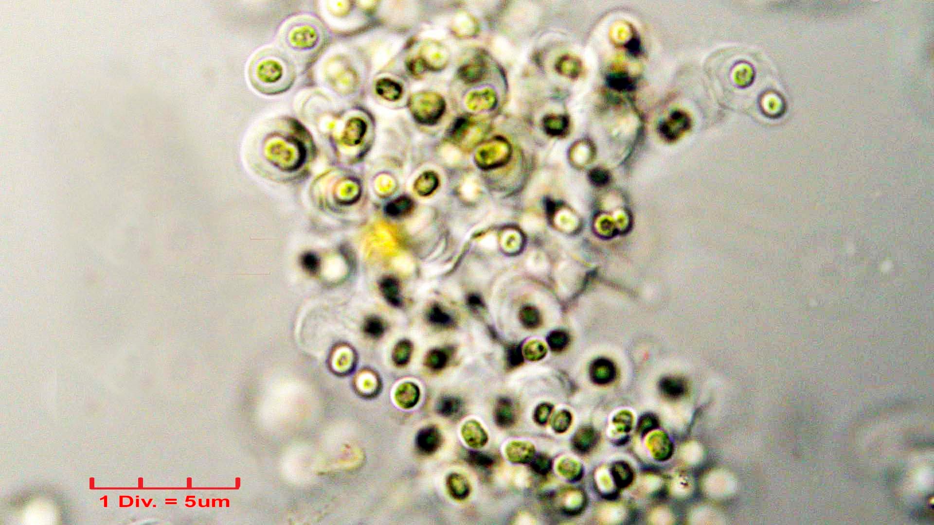 ./Cyanobacteria/Chroococcales/Chroococcaceae/Gloeocapsa/biformis/gloeocapsa-biformis-39.jpg