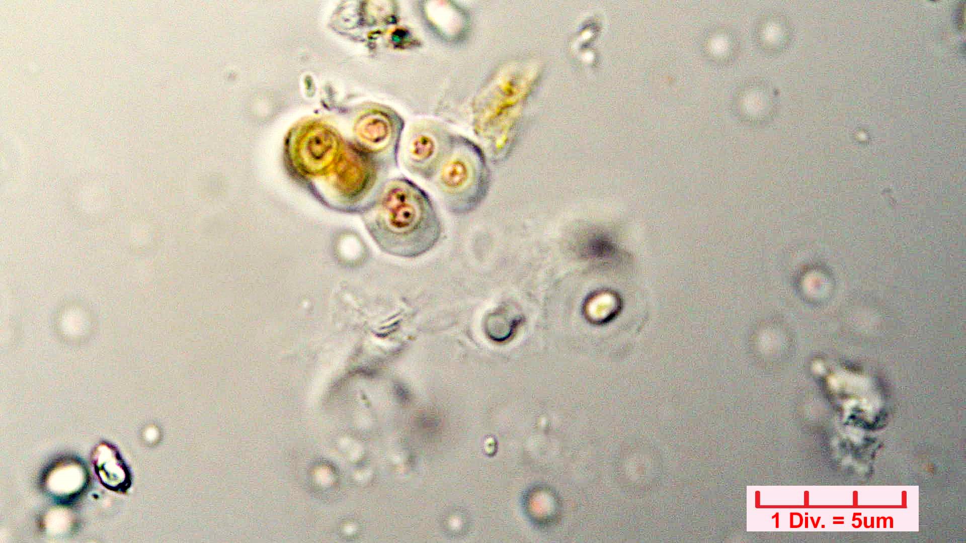 Cyanobacteria/Chroococcales/Chroococcaceae/Gloeocapsa/biformis/gloeocapsa-biformis-40.jpg