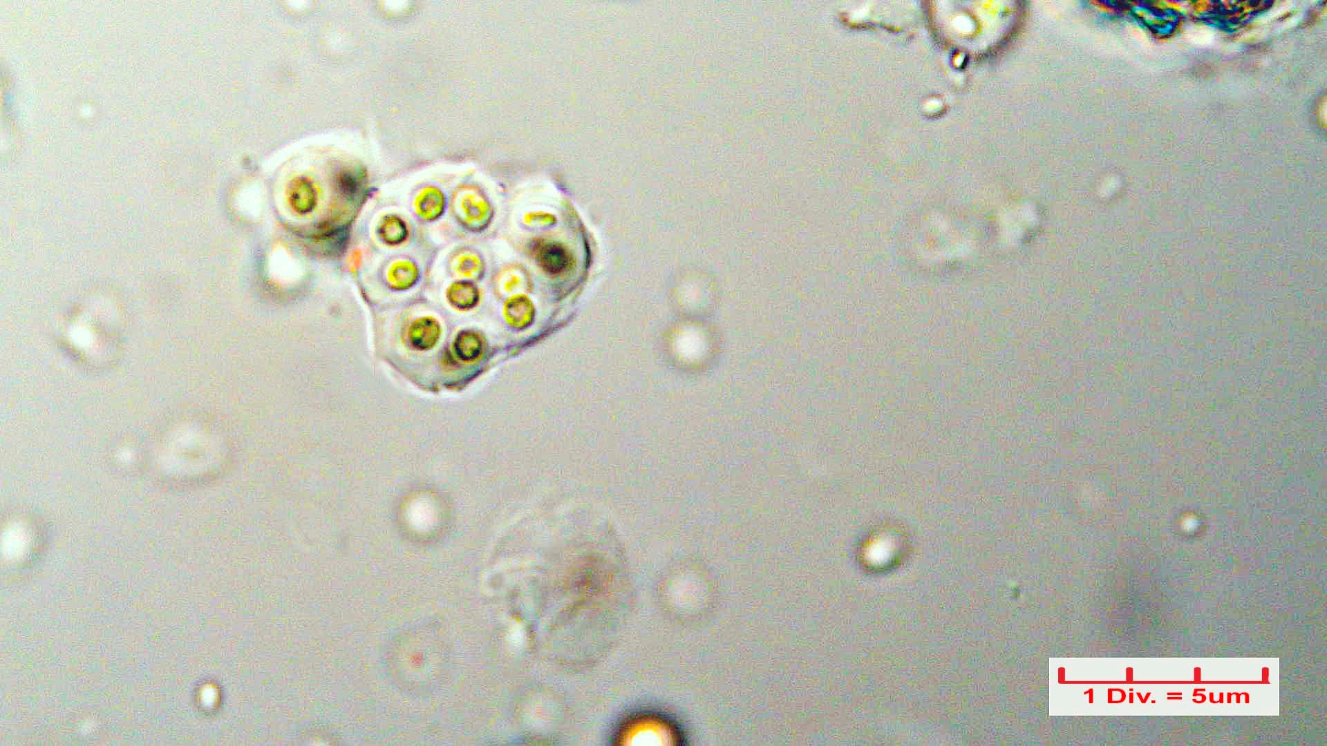 ./././Cyanobacteria/Chroococcales/Chroococcaceae/Gloeocapsa/biformis/gloeocapsa-biformis-41.jpg
