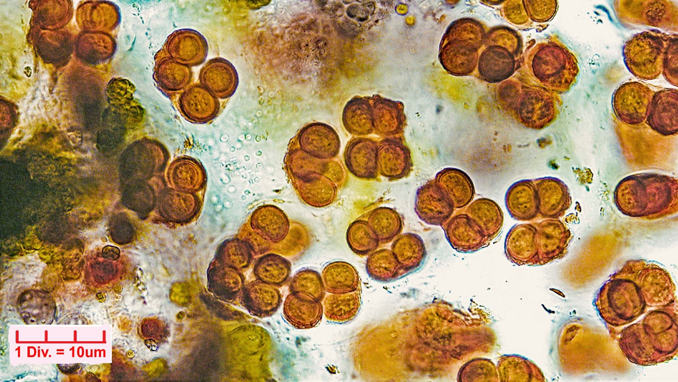 ./Cyanobacteria/Chroococcales/Chroococcaceae/Gloeocapsa/rupestris/gloeocapsa-rupestris-36.png