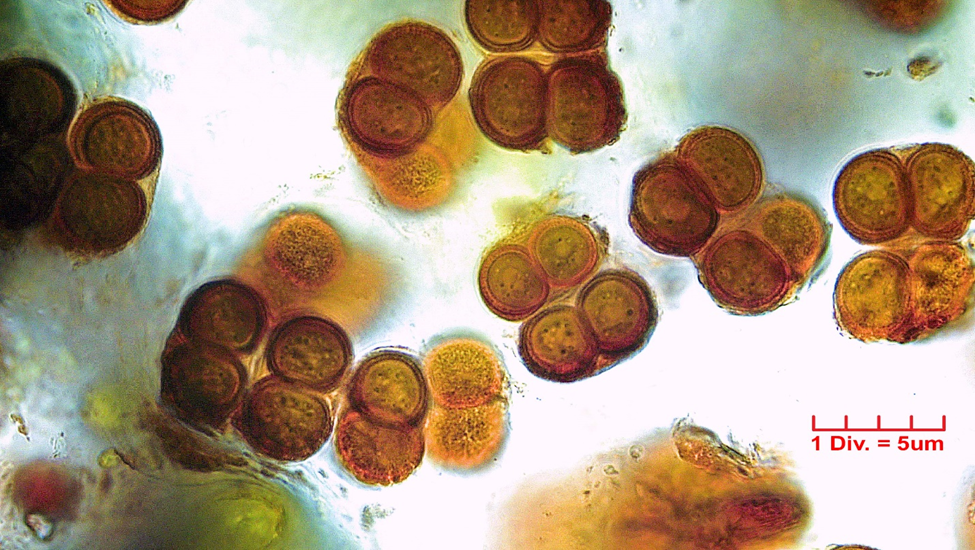 ././././Cyanobacteria/Chroococcales/Chroococcaceae/Gloeocapsa/rupestris/gloeocapsa-rupestris-37.png