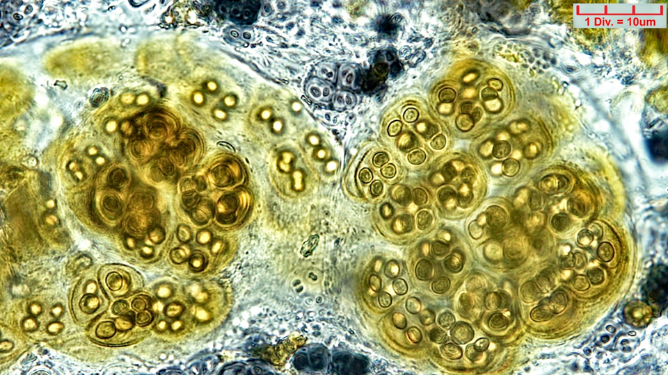 ././Cyanobacteria/Chroococcales/Chroococcaceae/Gloeocapsopsis/pleurocapsoides/gloeocapsopsis-pleurocapsoides-51.png