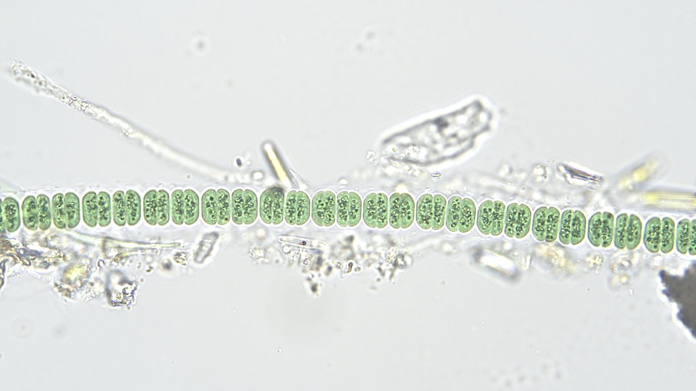 Cyanobacteria/Chroococcales/Cyanothricaceae/Johannesbaptistia/sp/johannesbaptistia-1a.jpg
