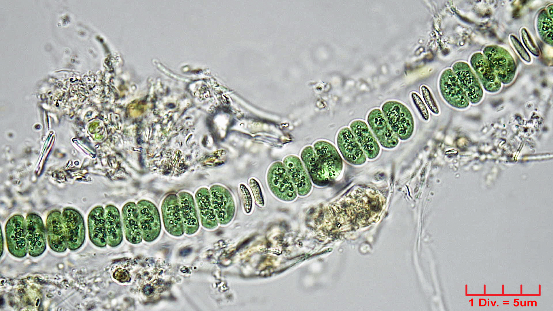 Cyanobacteria/Chroococcales/Cyanothricaceae/Johannesbaptistia/sp/johannesbaptistia-4.jpg