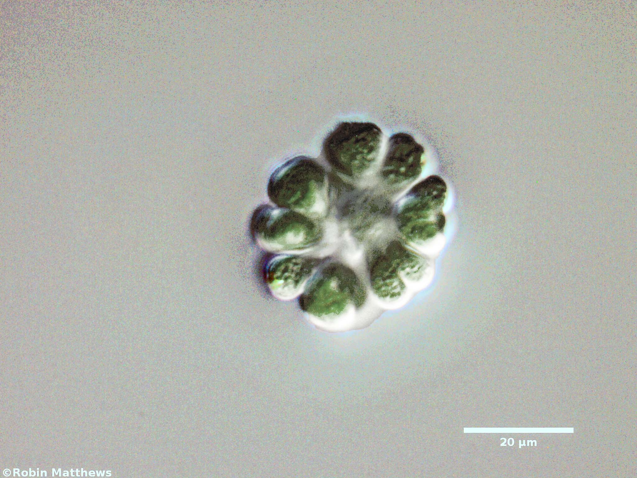 Cyanobacteria/Chroococcales/Gomphosphaeriaceae/Gomphosphaeria/aponina/gomphosphaeria-aponia-54.jpg
