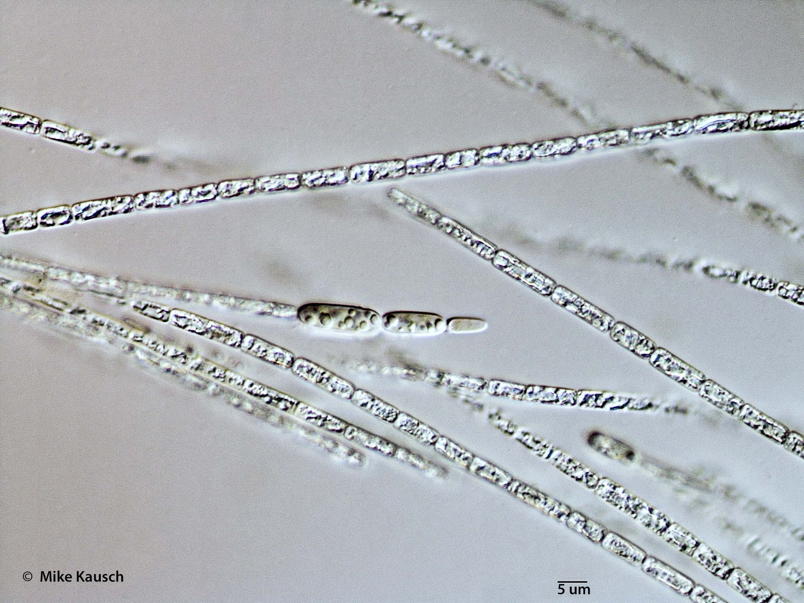 Cyanobacteria/Nostocales/Aphanizomenonaceae/Cylindrospermopsis/raciborskii/cylindrospermopsis-582.jpg