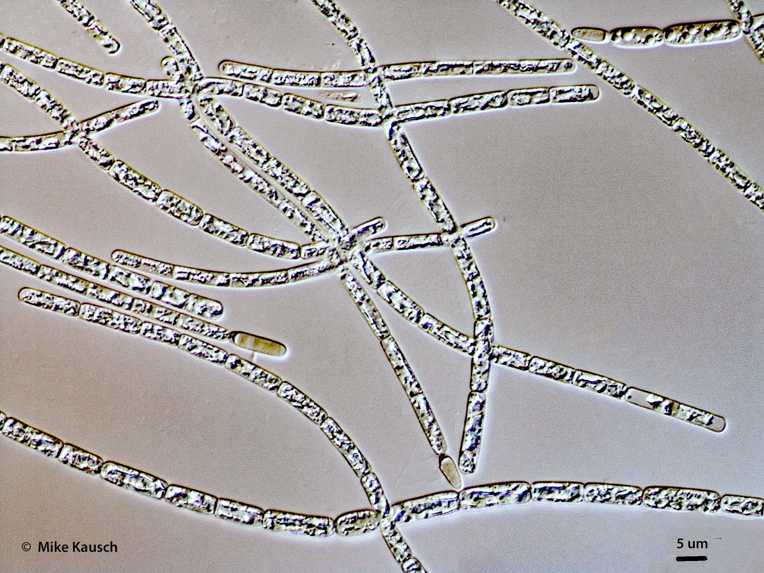 Cyanobacteria/Nostocales/Aphanizomenonaceae/Cylindrospermopsis/raciborskii/cylindrospermopsis-583.jpg