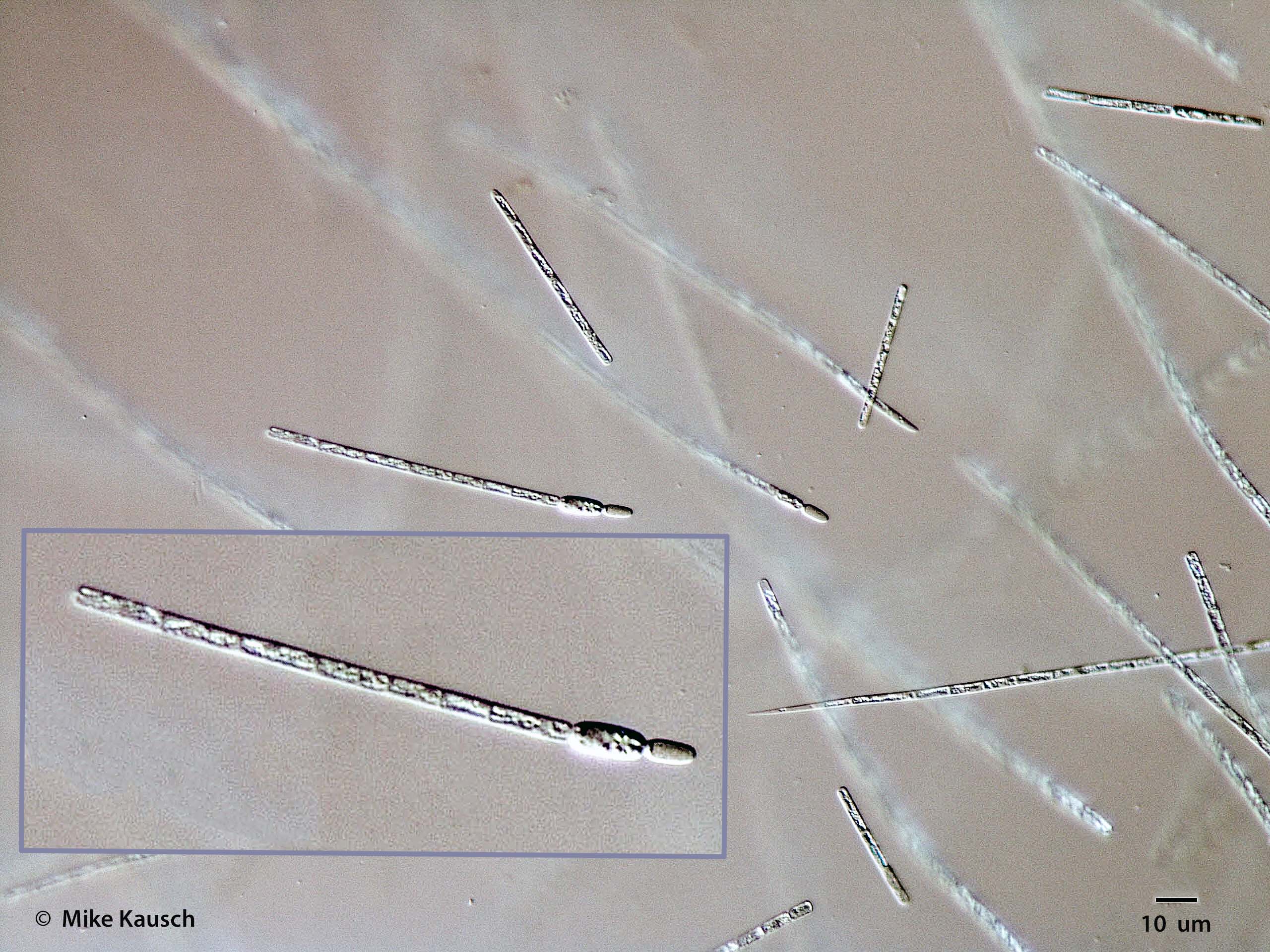 Cyanobacteria/Nostocales/Aphanizomenonaceae/Cylindrospermopsis/raciborskii/cylindrospermopsis-584.jpg