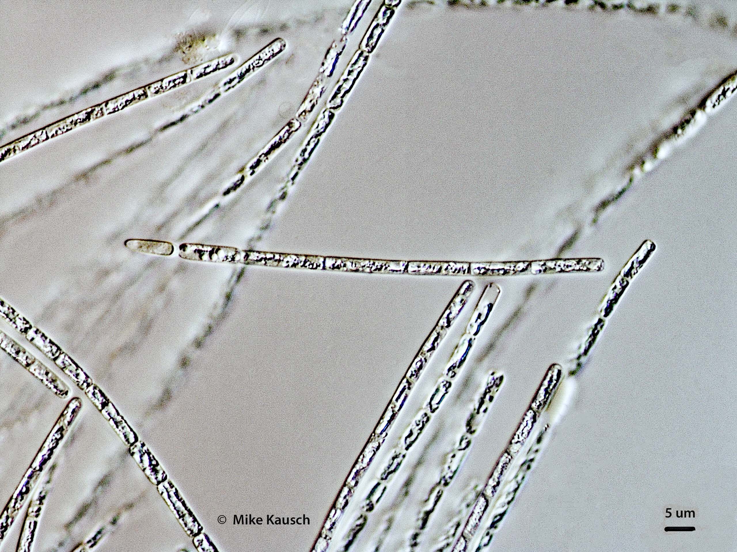 Cyanobacteria/Nostocales/Aphanizomenonaceae/Cylindrospermopsis/raciborskii/cylindrospermopsis-585.jpg