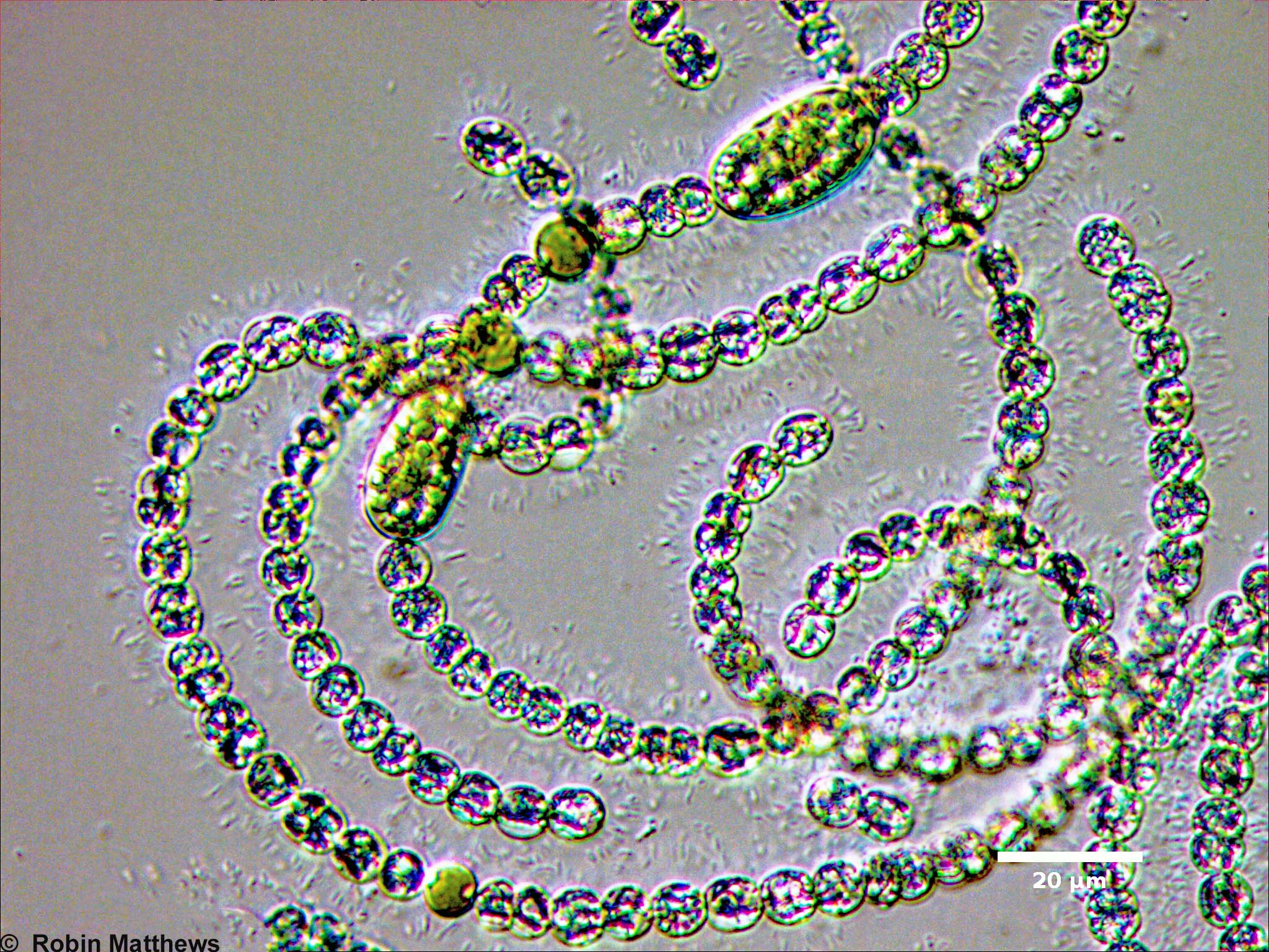 Cyanobacteria/Nostocales/Aphanizomenonaceae/Dolichospermum/circinale/dolichospermum-555.jpg