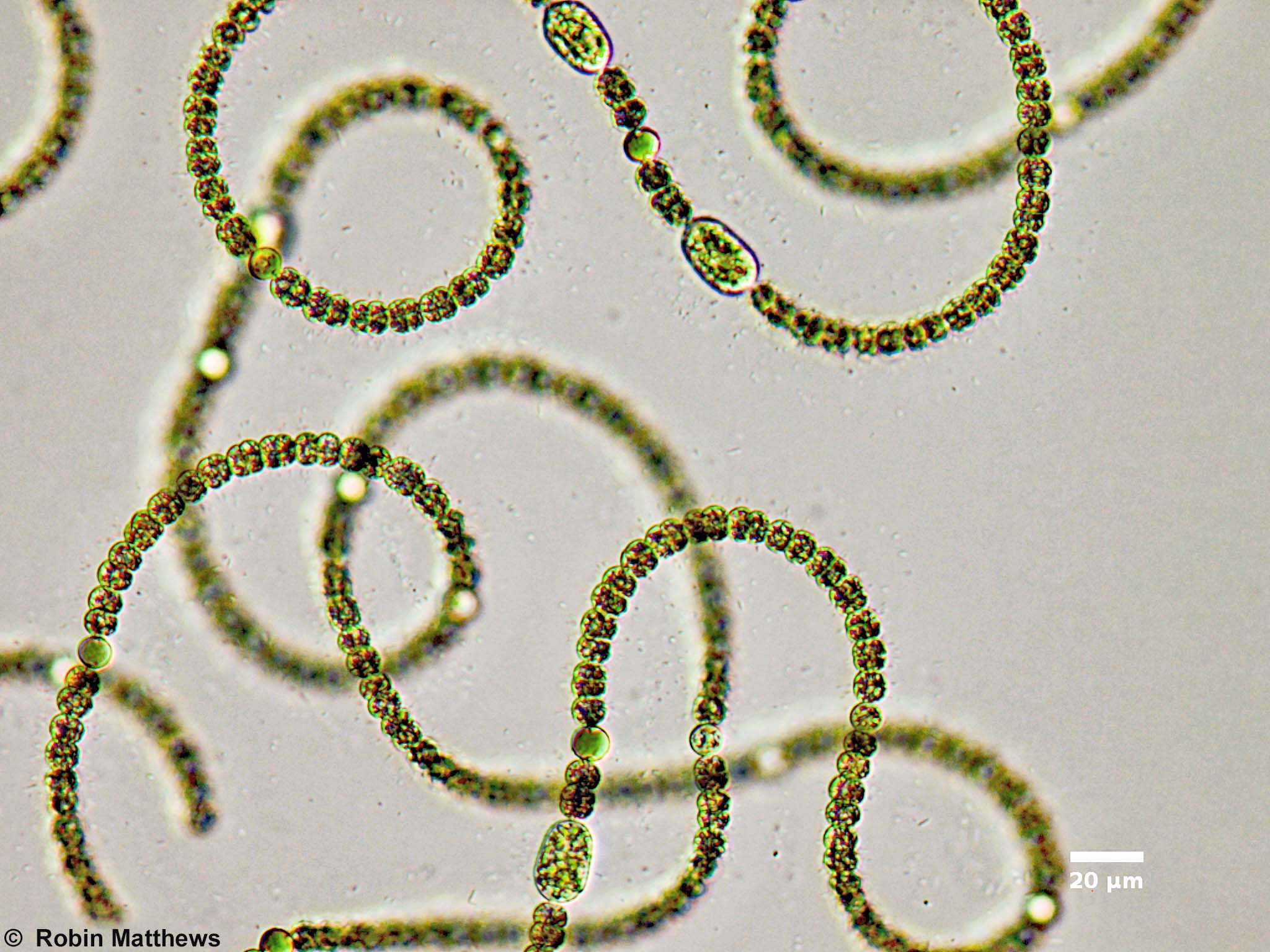 ././Cyanobacteria/Nostocales/Aphanizomenonaceae/Dolichospermum/circinale/dolichospermum-556.jpg