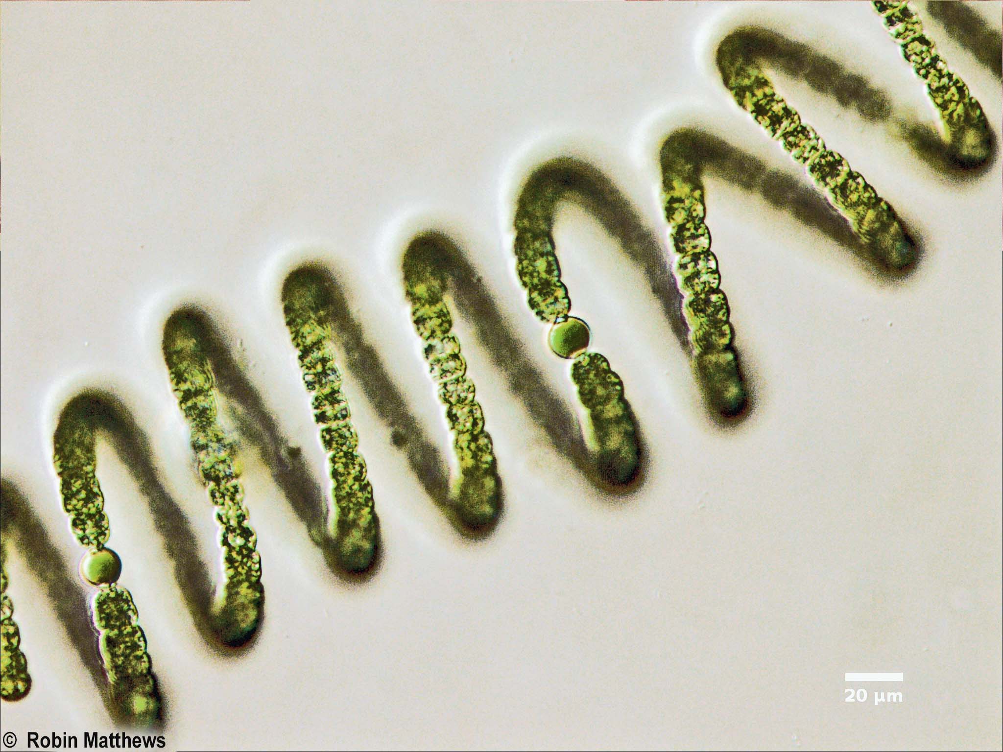 Cyanobacteria/Nostocales/Aphanizomenonaceae/Dolichospermum/crassum/dolichospermum-558.jpg