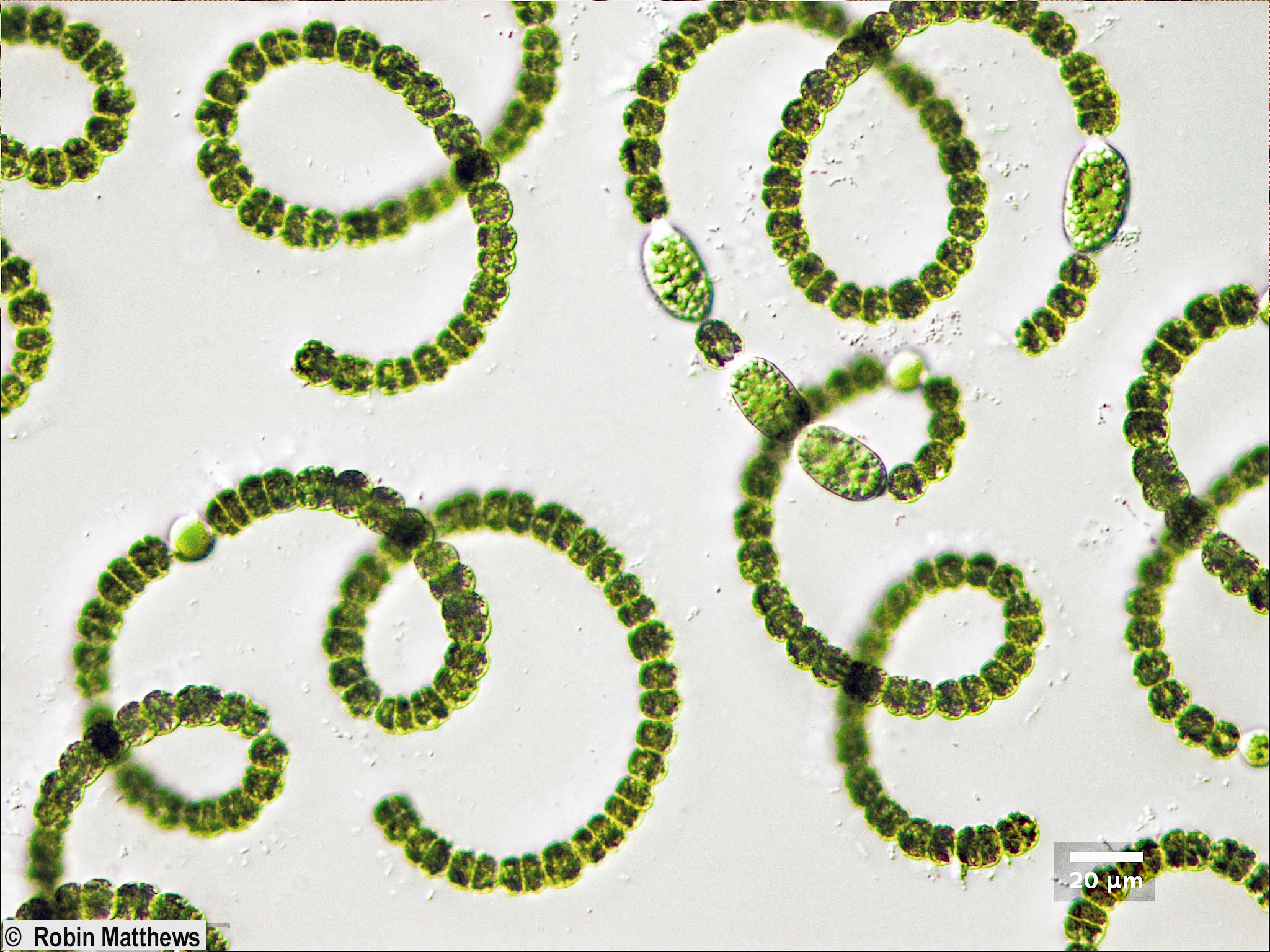 Cyanobacteria/Nostocales/Aphanizomenonaceae/Dolichospermum/crassum/dolichospermum-560.jpg