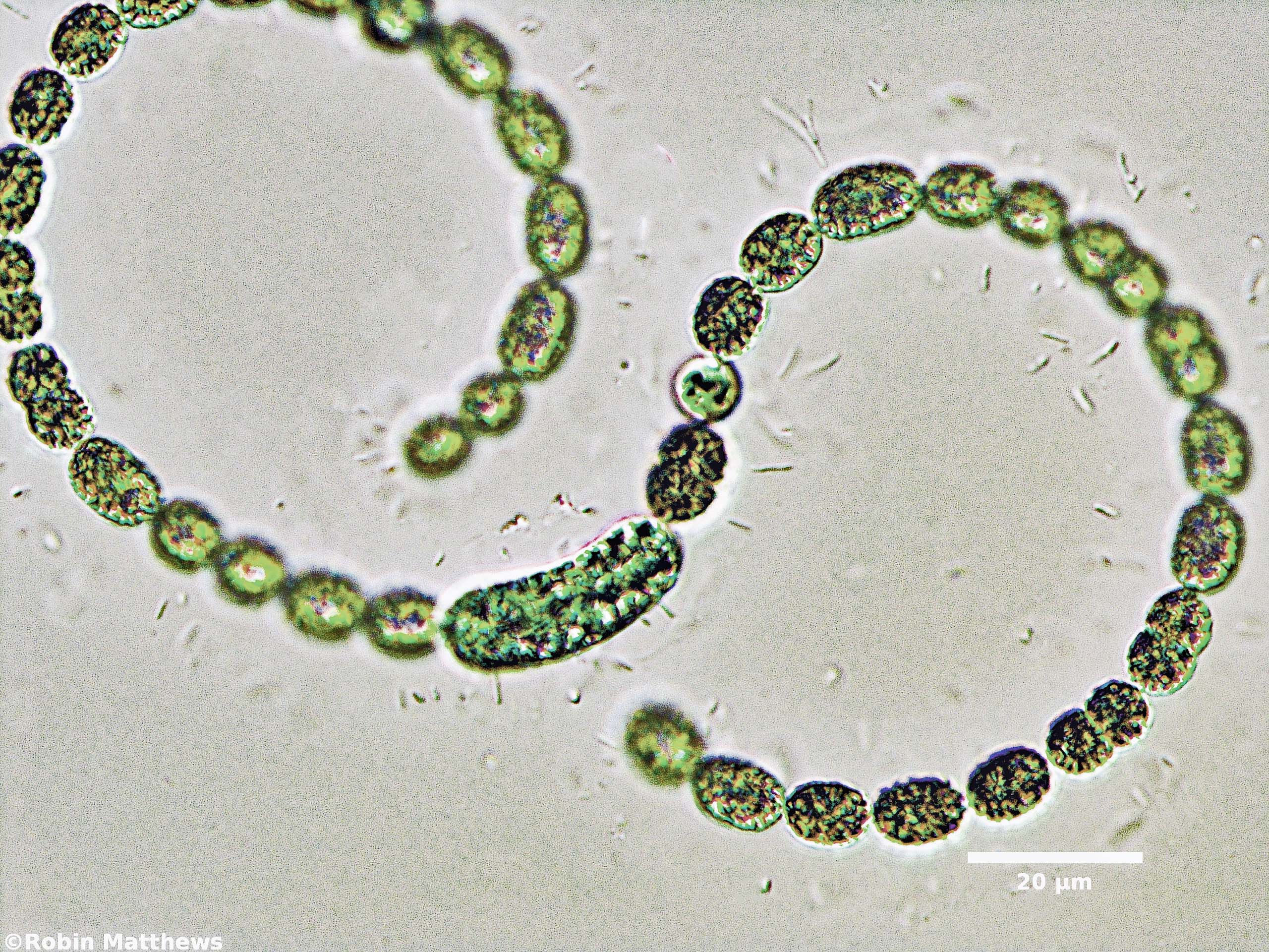 Cyanobacteria/Nostocales/Aphanizomenonaceae/Dolichospermum/ellipsoides/dolichospermum-565.jpg