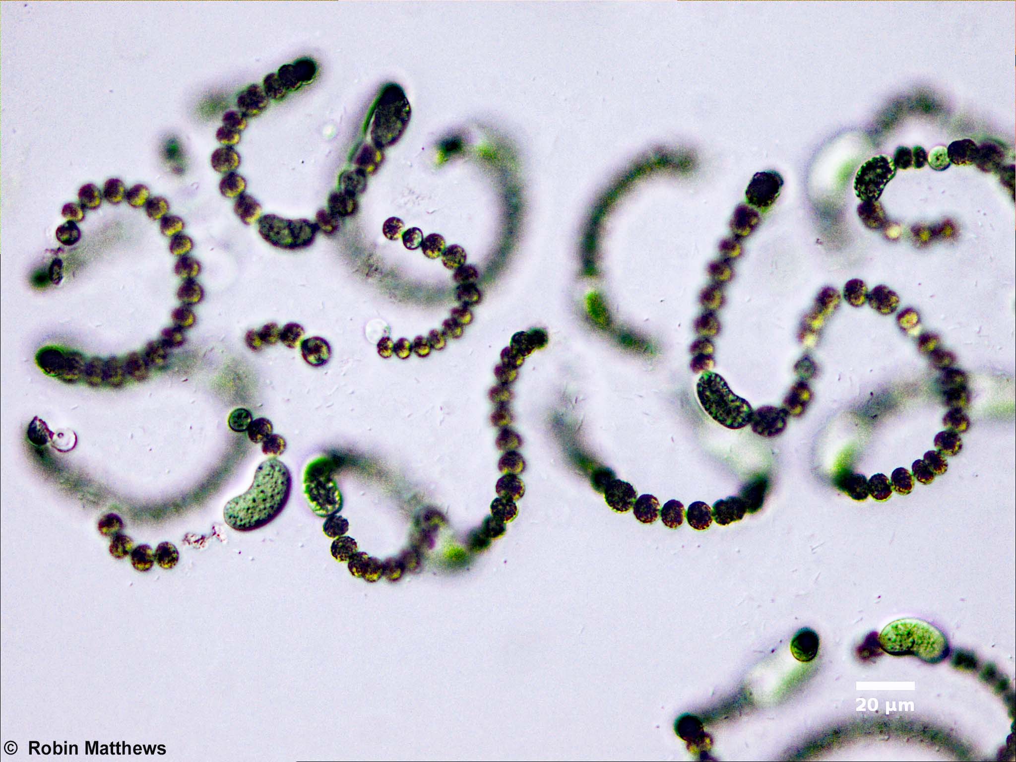 Cyanobacteria/Nostocales/Aphanizomenonaceae/Dolichospermum/flos-aquae/dolichospermum-566.jpg