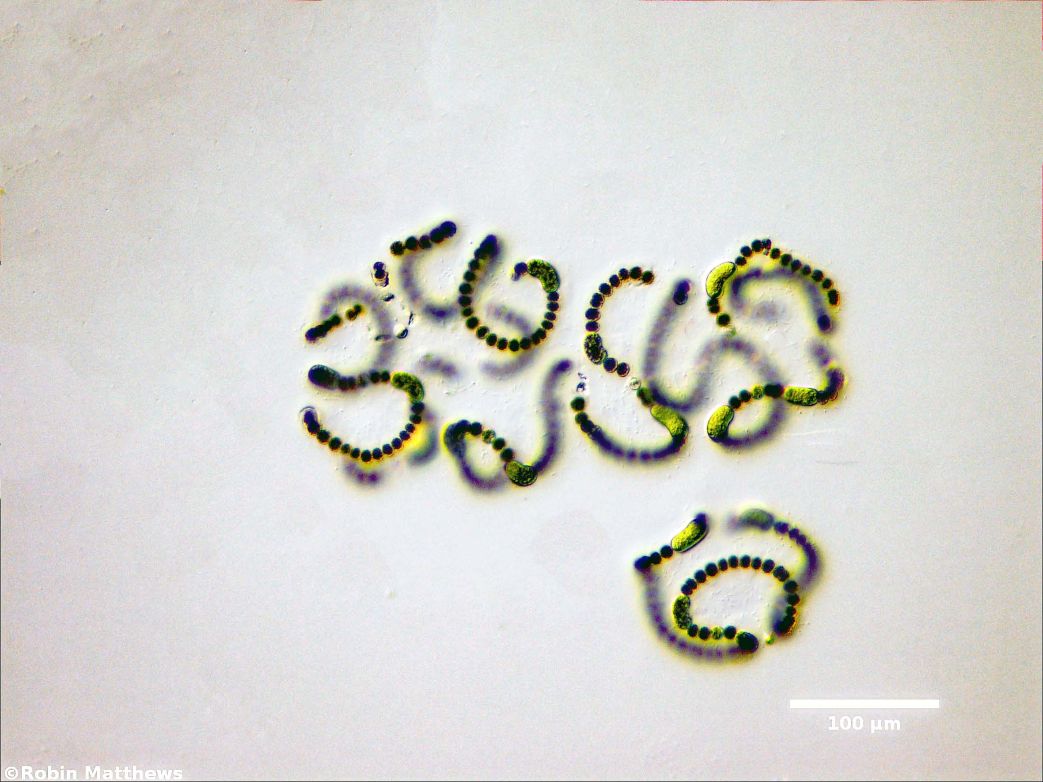 Cyanobacteria/Nostocales/Aphanizomenonaceae/Dolichospermum/flos-aquae/dolichospermum-567.jpg