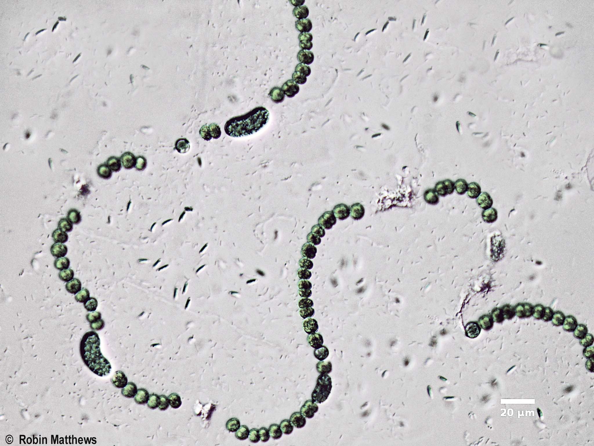././Cyanobacteria/Nostocales/Aphanizomenonaceae/Dolichospermum/flos-aquae/dolichospermum-568.jpg