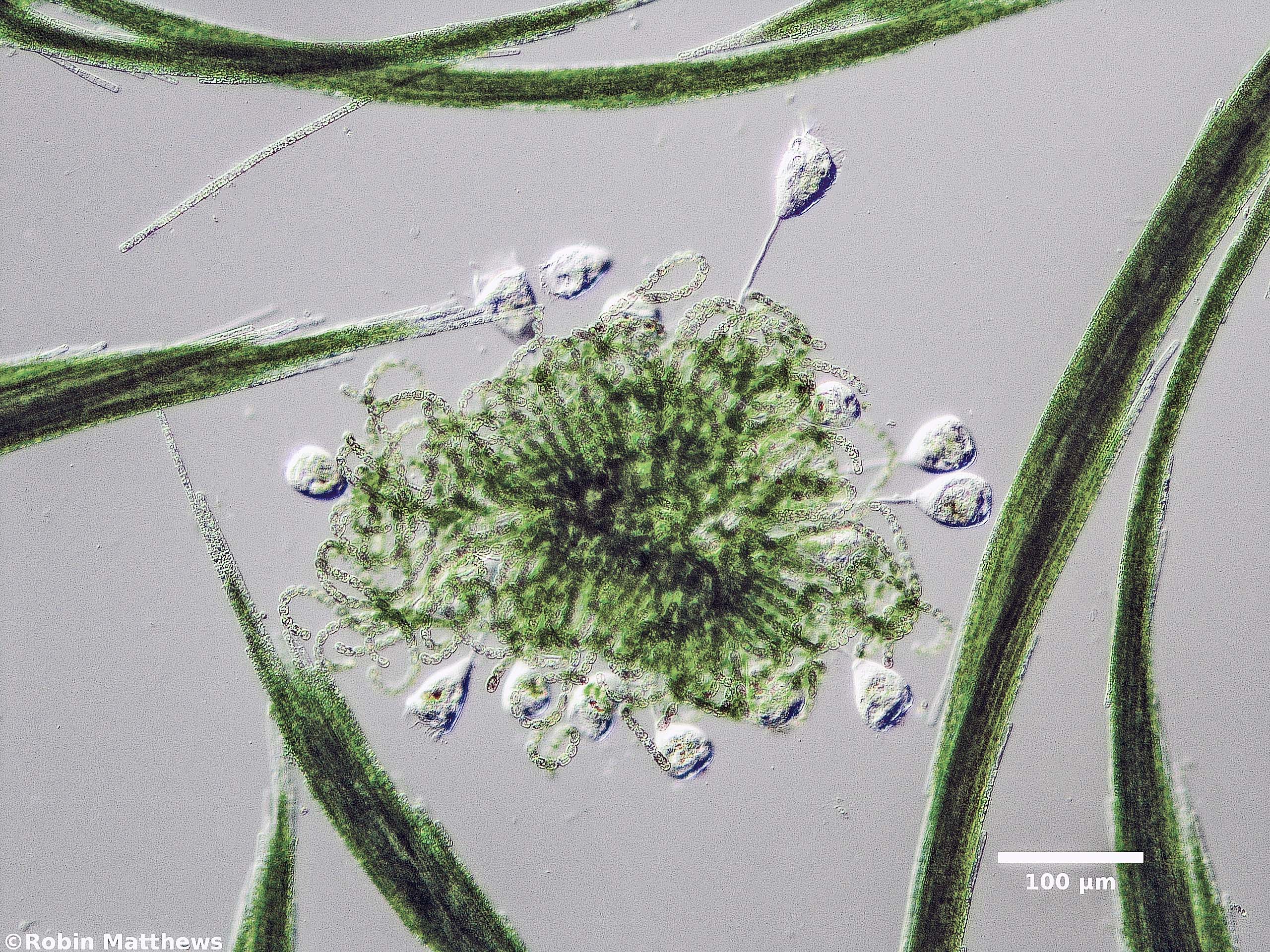 Cyanobacteria/Nostocales/Aphanizomenonaceae/Dolichospermum/lemmermannii/dolichospermum-569.jpg
