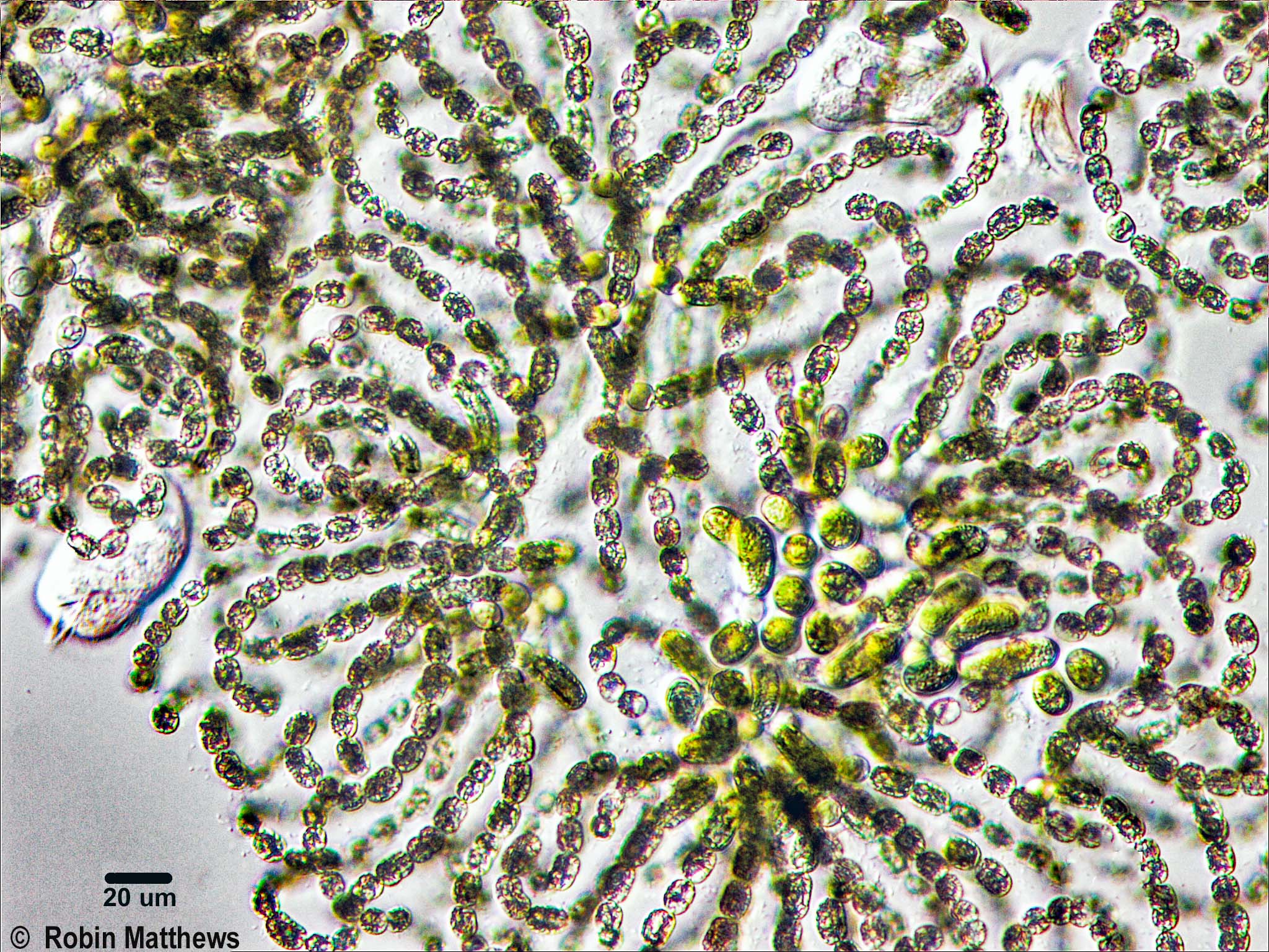Cyanobacteria/Nostocales/Aphanizomenonaceae/Dolichospermum/lemmermannii/dolichospermum-570.jpg