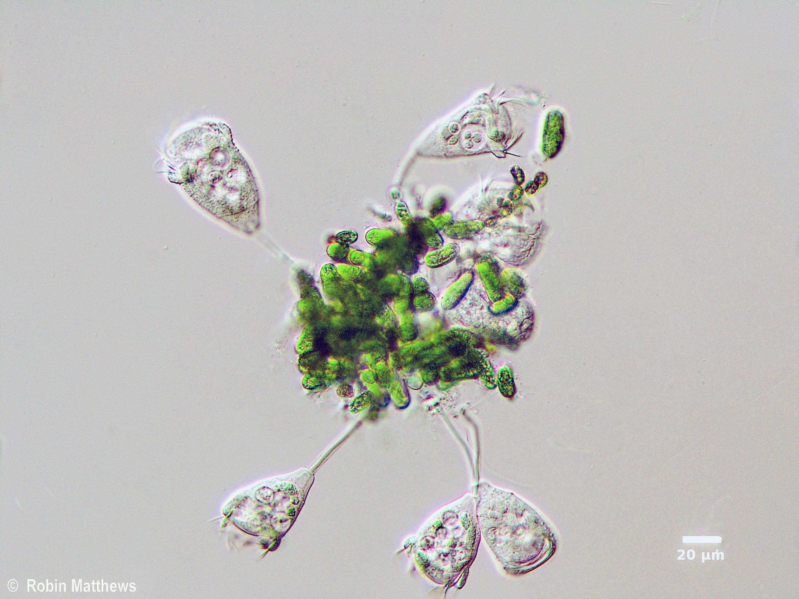 Cyanobacteria/Nostocales/Aphanizomenonaceae/Dolichospermum/lemmermannii/dolichospermum-572.jpg