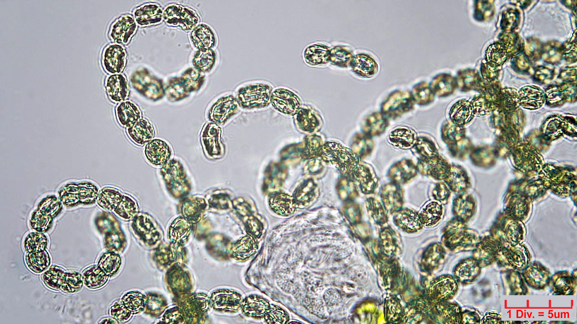 Cyanobacteria/Nostocales/Aphanizomenonaceae/Dolichospermum/lemmermannii/dolichospermum-574.jpg