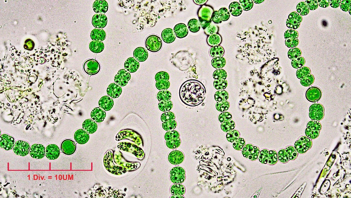 ./Cyanobacteria/Nostocales/Aphanizomenonaceae/Dolichospermum/sp/dolichospermum-551.jpg